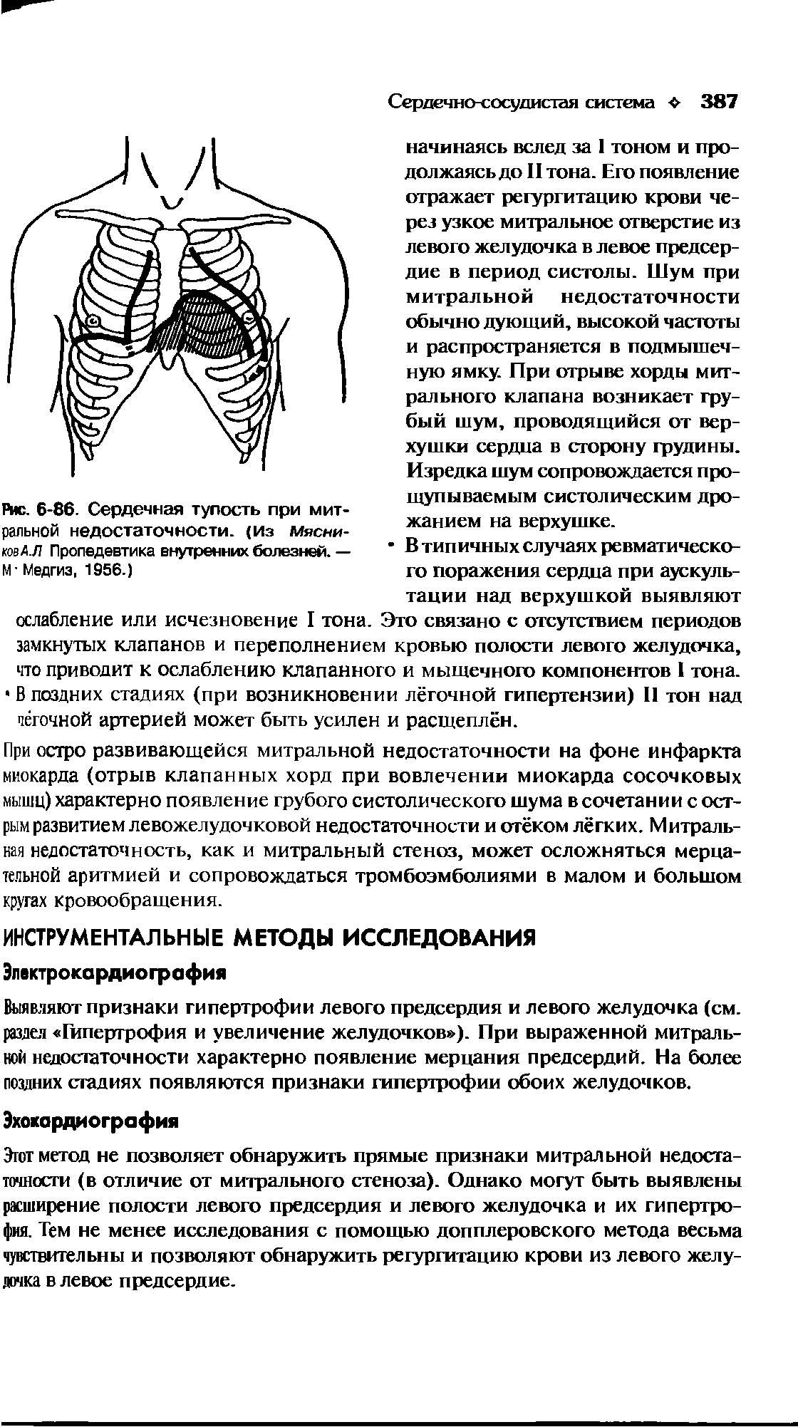 Рис. 6-86. Сердечная тупость при митральной недостаточности. (Из мясни-иовА.Л Пропедевтика внутренних болезней.— М Медгиз, 1956.)...