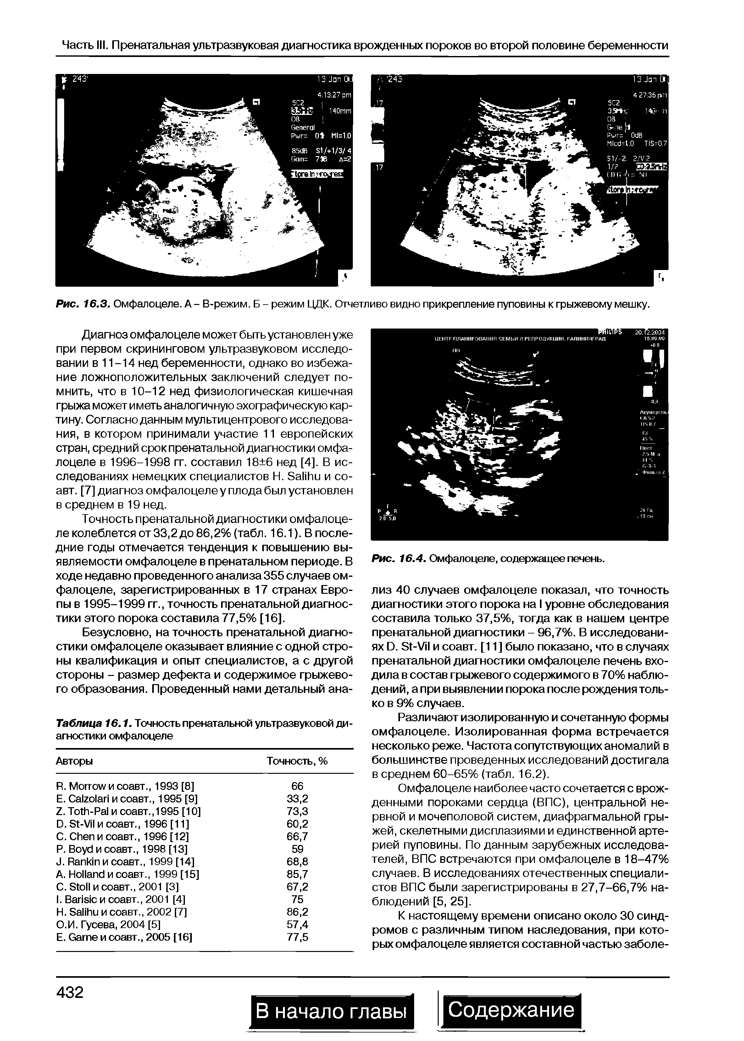 Таблица 16.1. Точность пренатальной ультразвуковой диагностики омфалоцеле...