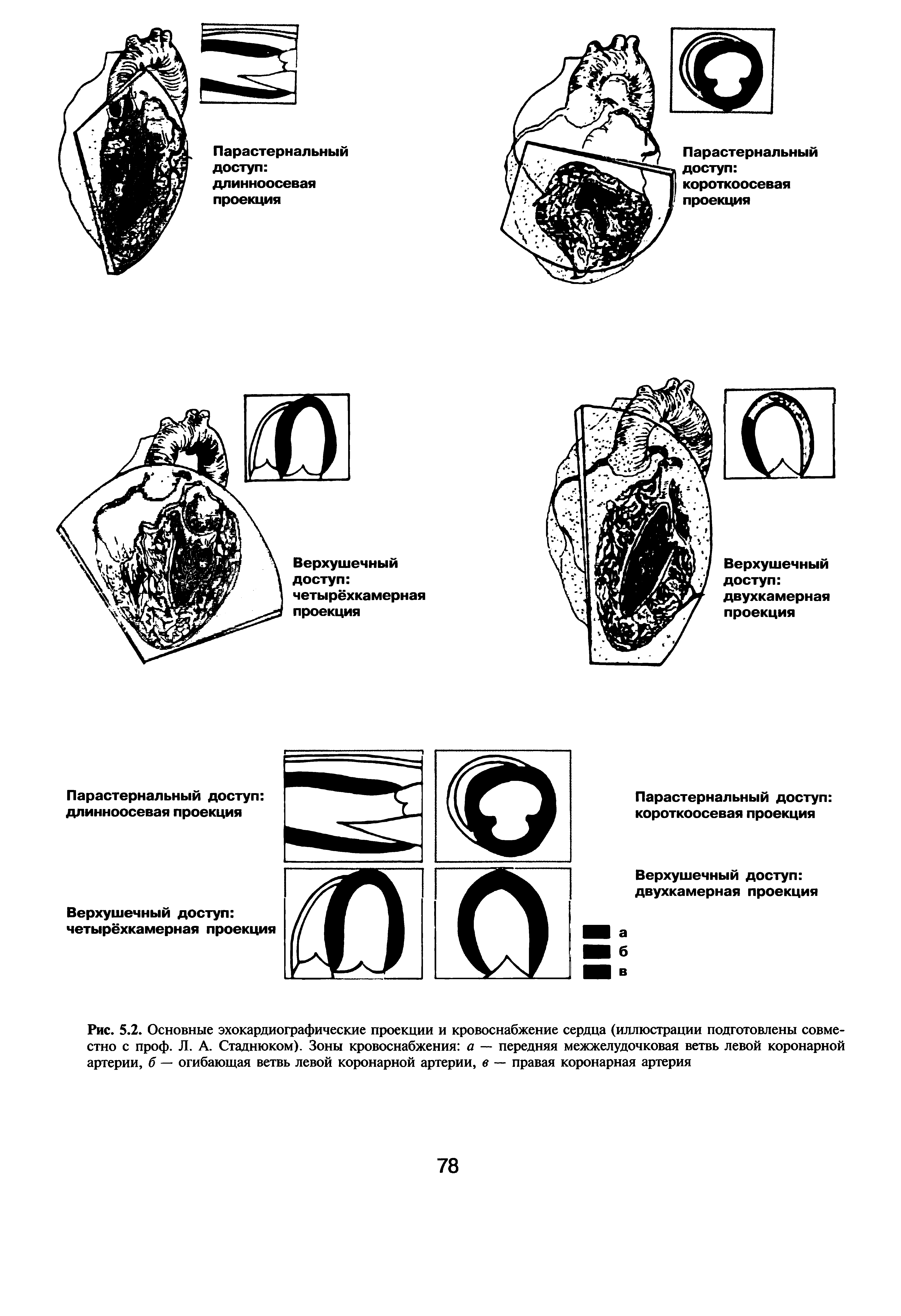 Рис. 5.2. Основные эхокардиографические проекции и кровоснабжение сердца (иллюстрации подготовлены совместно с проф. Л. А. Стаднюком). Зоны кровоснабжения а — передняя межжелудочковая ветвь левой коронарной артерии, б — огибающая ветвь левой коронарной артерии, в — правая коронарная артерия...