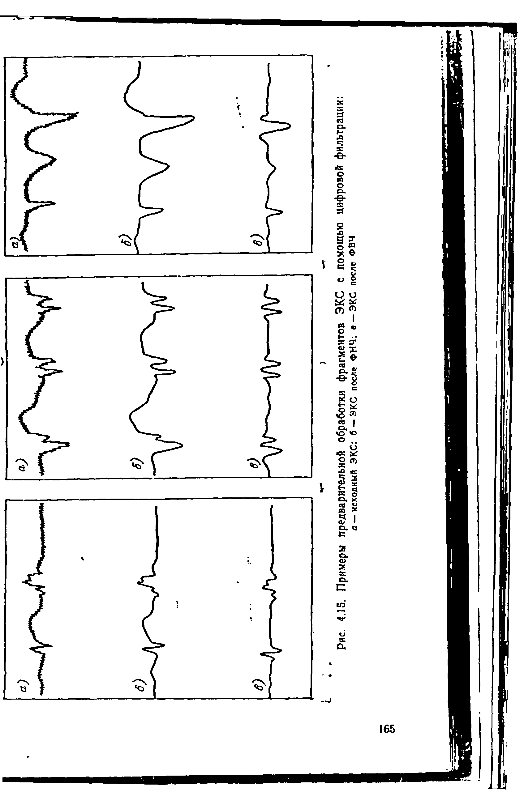 Рис. 4.15. Примеры предварительной обработки фрагментов ЭКС с помощью цифровой фильтрации а — исходный ЭКС б — ЭКС после ФНЧ в — ЭКС после ФВЧ...