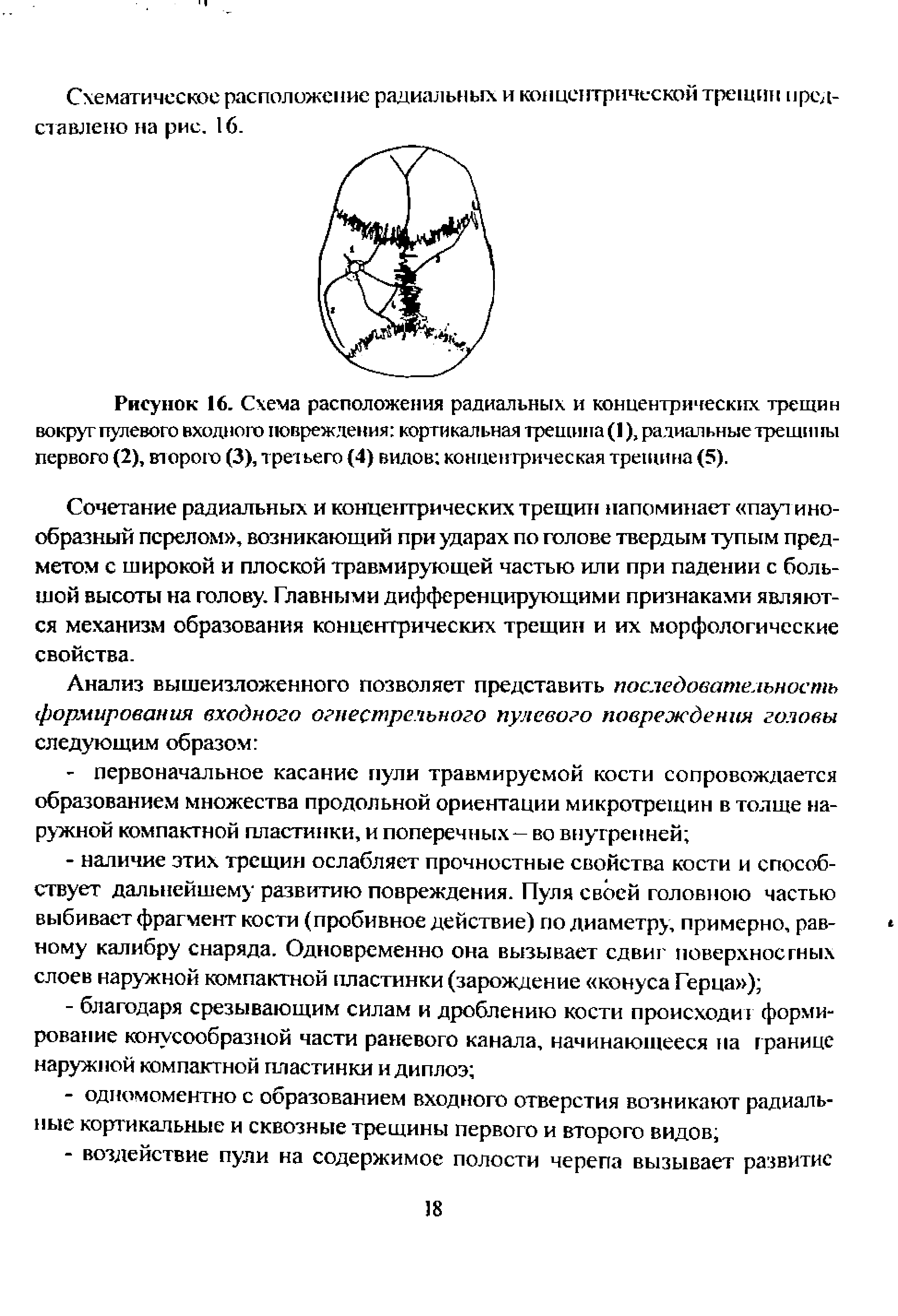 Рисунок 16. Схема расположения радиальных и концентрических трещин вокруг пулевого входного повреждения кортикальная трещина (1), радиальные трещины первого (2), второго (3), третьего (4) видов концентрическая трещина (5).