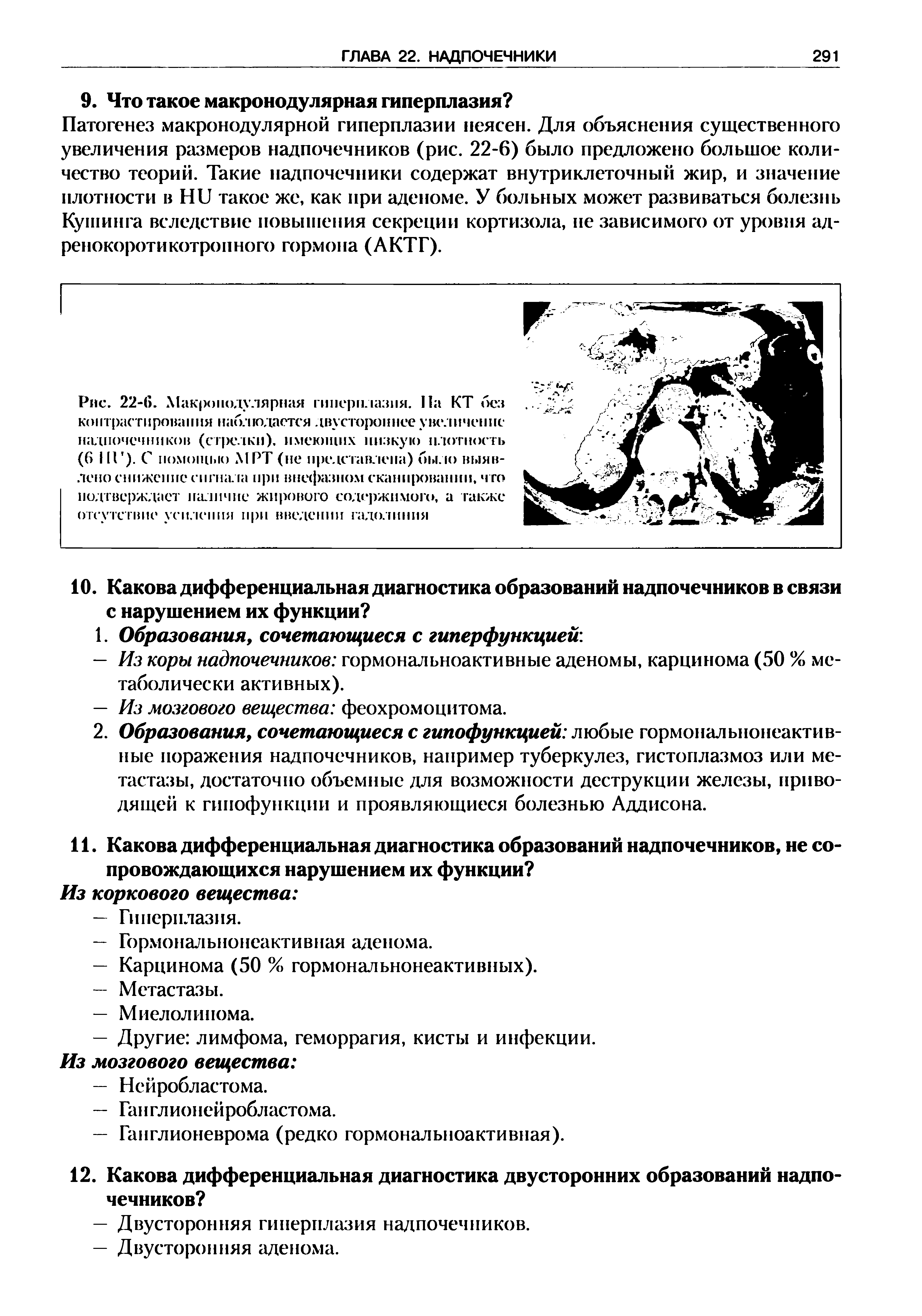 Рис. 22-6. Макронодулярная гиперплазия. Па КТ без контрастирования наблюдается двустороннее увеличение надпочечников (ст х лкп). имеющих низкую плотность (6 III ). С помощью МРТ (не представлена) было выявлено снижение сигнала при ппефазном сканировании, ч го подтверждает наличие жирового содержимого, а также отсутствие усилен пи при введении гадолиния...