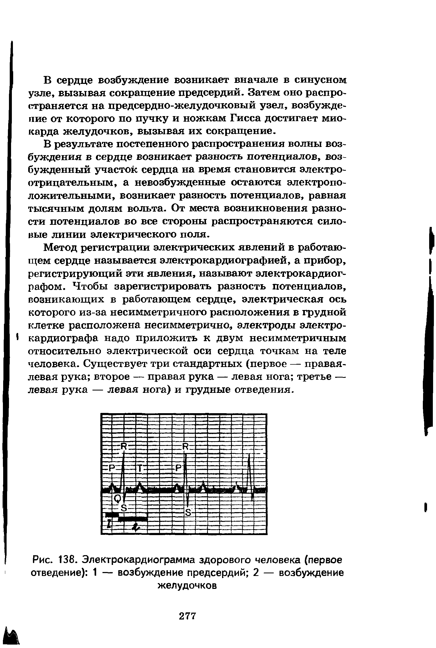 Рис. 138. Электрокардиограмма здорового человека (первое отведение) 1 — возбуждение предсердий 2 — возбуждение желудочков...