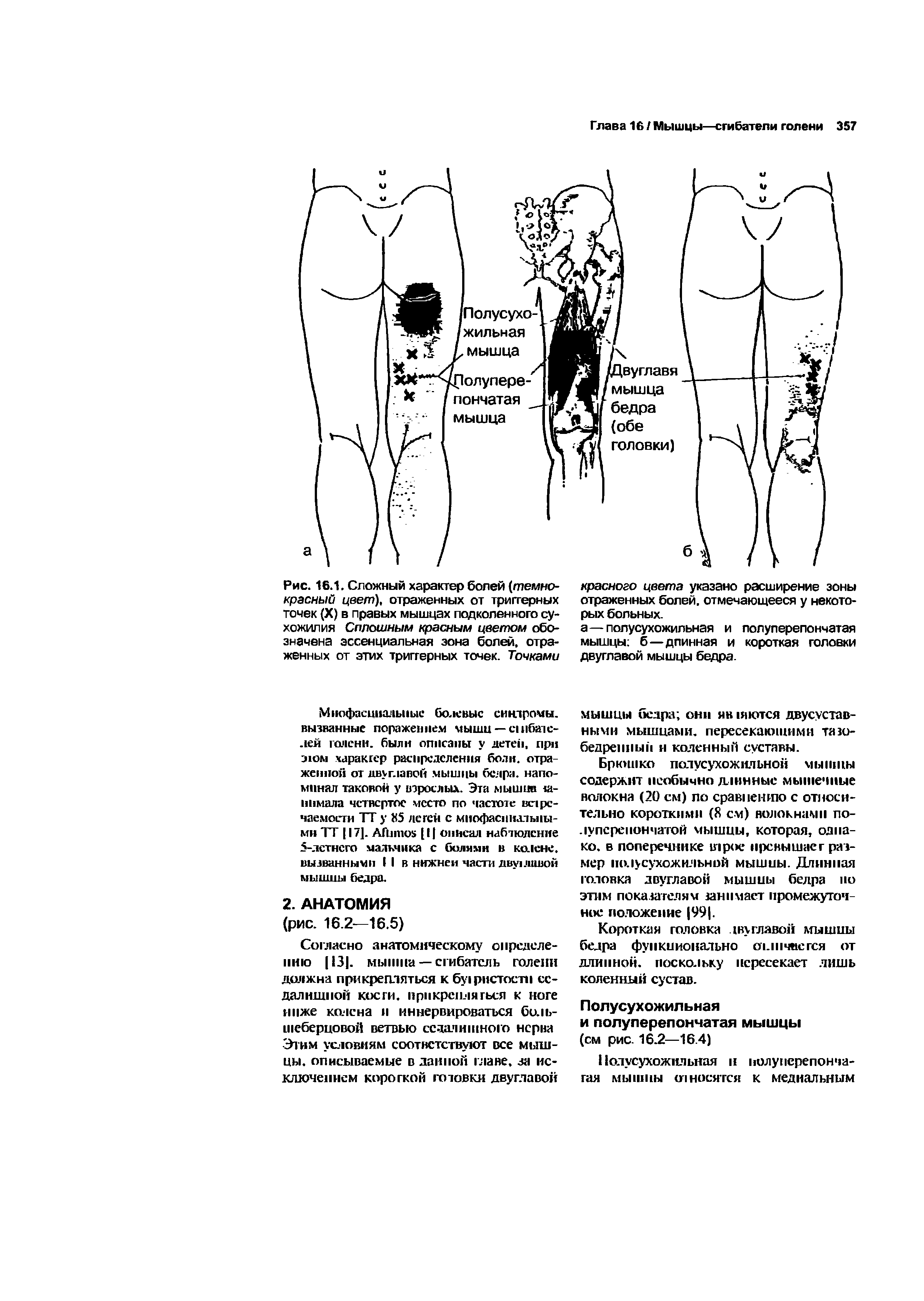 Рис. 16.1. Сложный характер болей (темнокрасный цвет), отраженных от триггерных точек (X) в правых мышцах подколенного сухожилия Сплошным красным цветом обозначена эссенциальная зона болей, отраженных от этих триггерных точек. Точками...