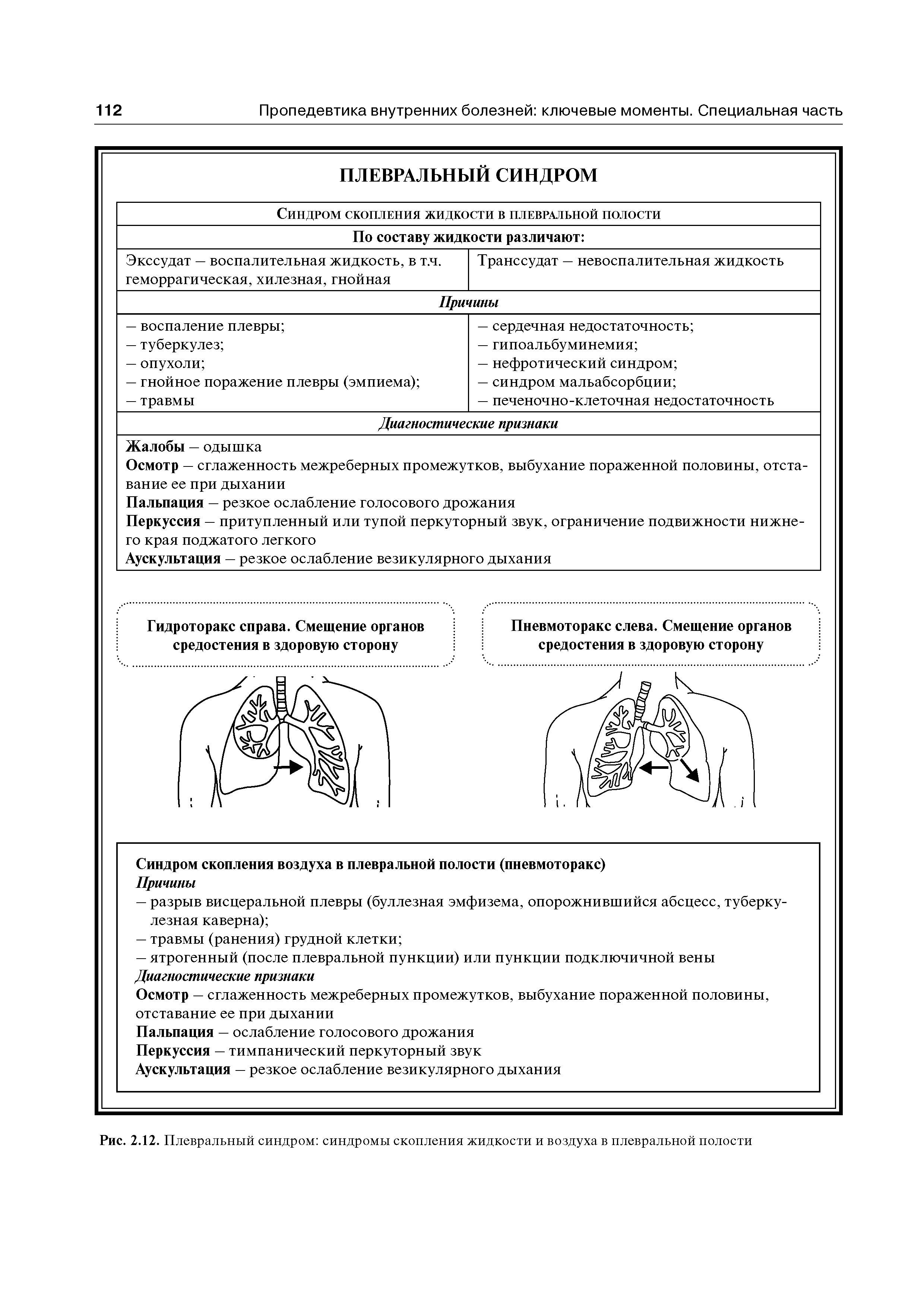 Рис. 2.12. Плевральный синдром синдромы скопления жидкости и воздуха в плевральной полости...