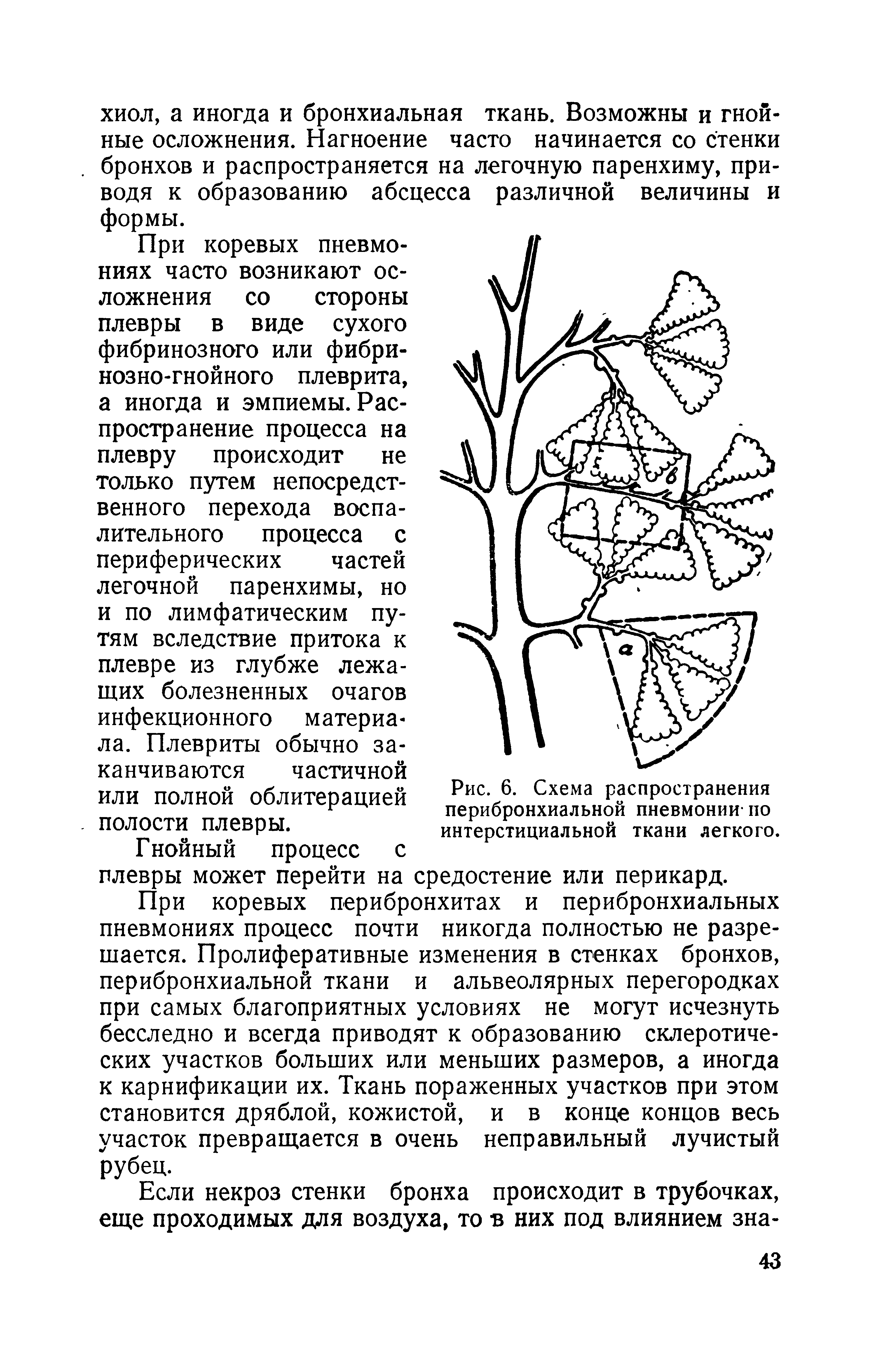 Рис. 6. Схема распространения перибронхиальной пневмонии- по интерстициальной ткани легкого.