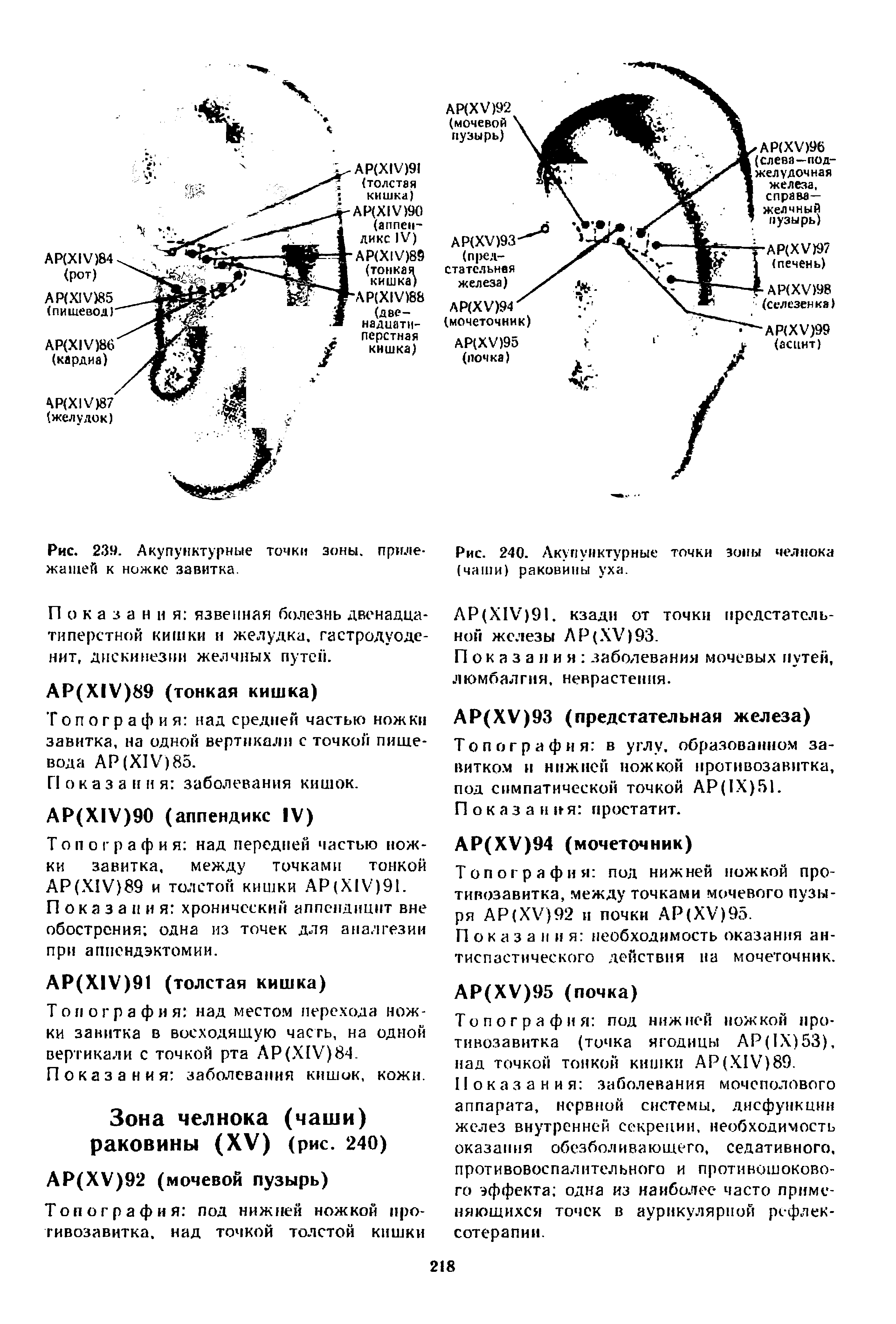 Рис. 240. Акупунктурные точки зоны челнока (чаши) раковины уха.