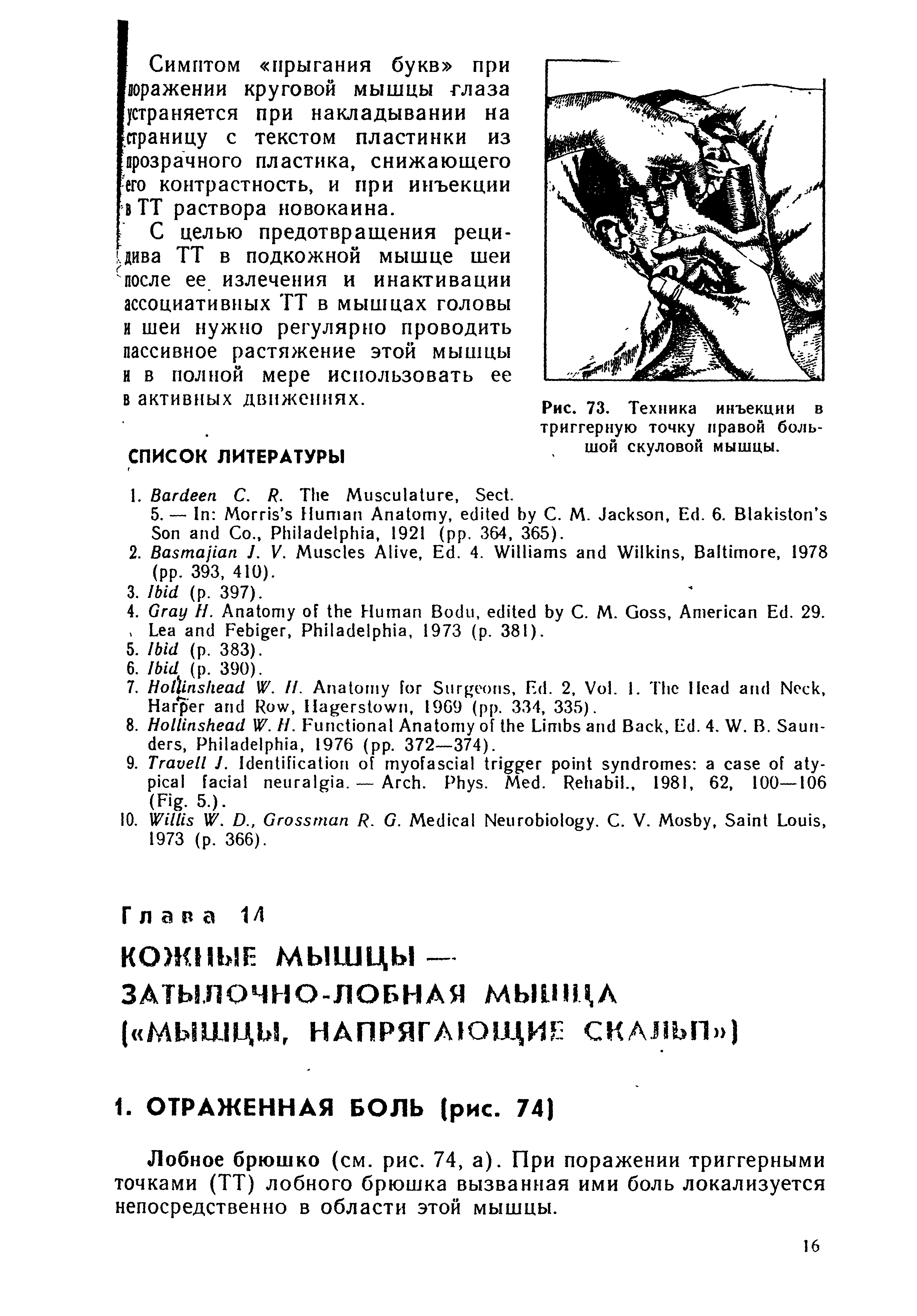 Рис. 73. Техника инъекции в триггерную точку правой большой скуловой мышцы.