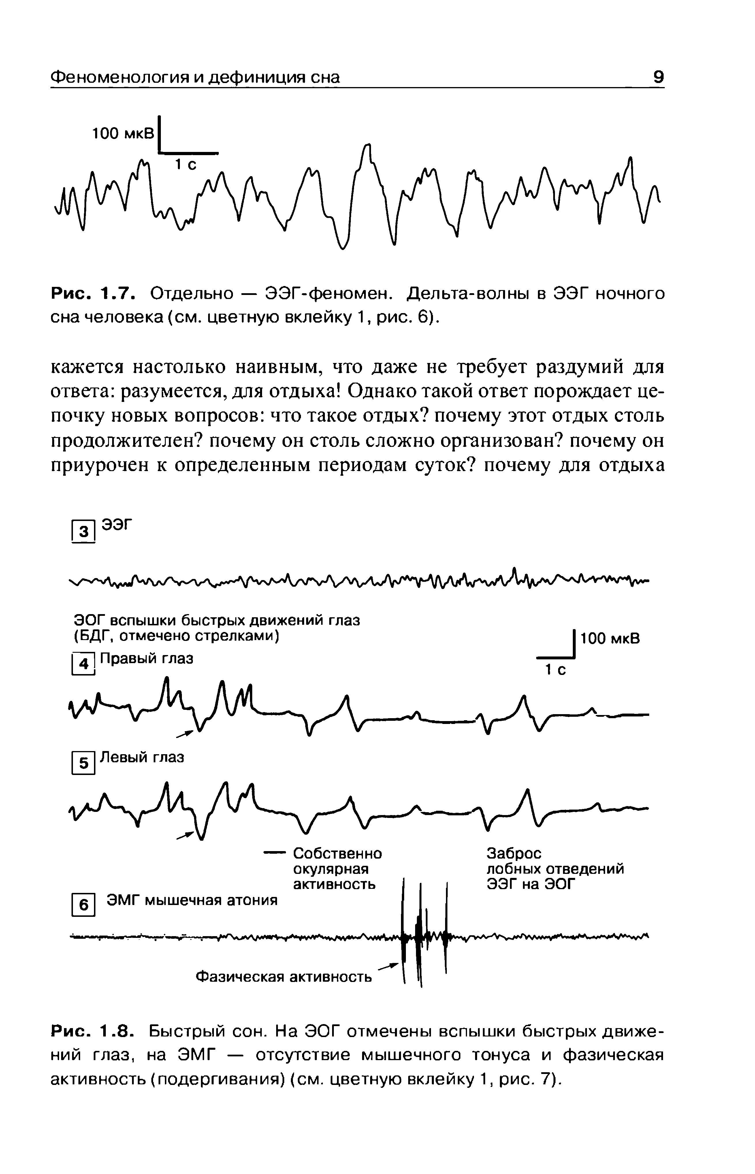 Рис. 1.8. Быстрый сон. На ЭОГ отмечены вспышки быстрых движений глаз, на ЭМГ — отсутствие мышечного тонуса и фазическая активность (подергивания) (см. цветную вклейку 1, рис. 7).