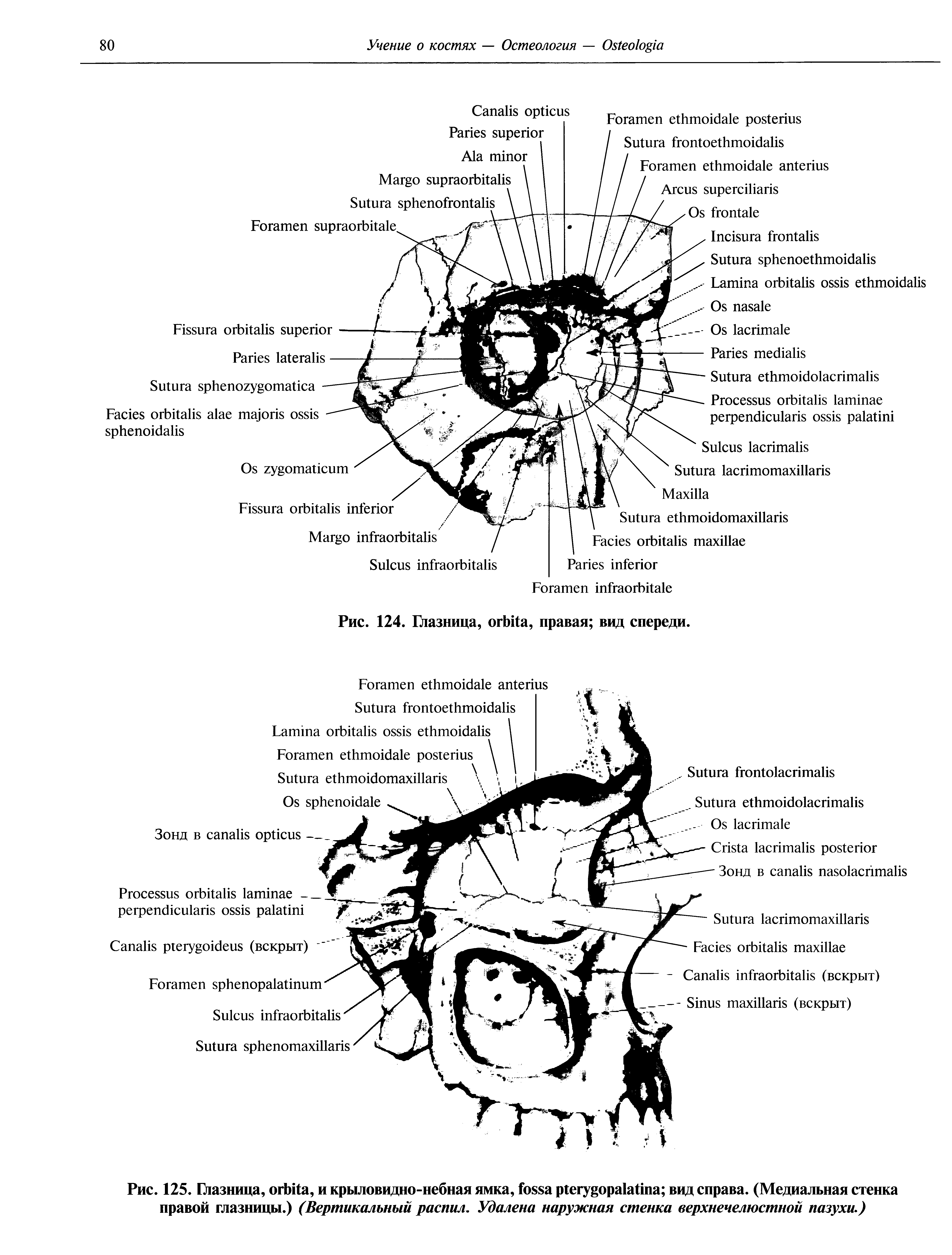 Рис. 125. Глазница, , и крыловидно-небная ямка, вид справа. (Медиальная стенка правой глазницы.) (Вертикальный распил. Удалена наружная стенка верхнечелюстной пазухи.)...