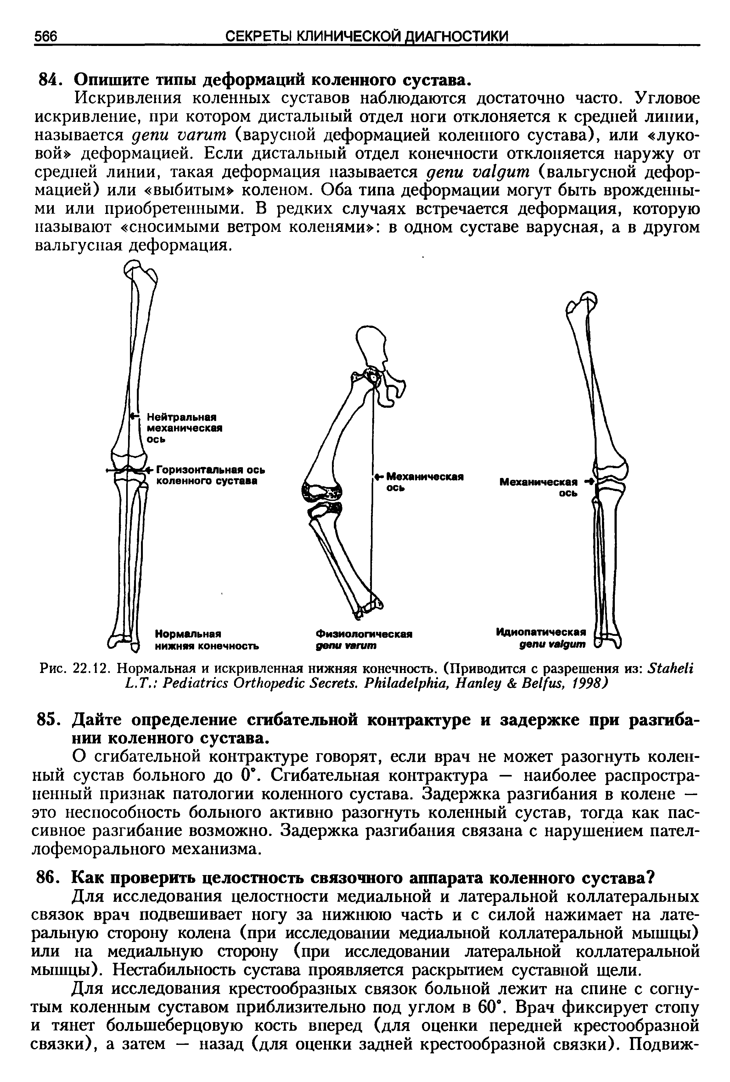 Рис. 22.12. Нормальная и искривленная нижняя конечность. (Приводится с разрешения из S L.T. P O S . P , H B , 1998)...