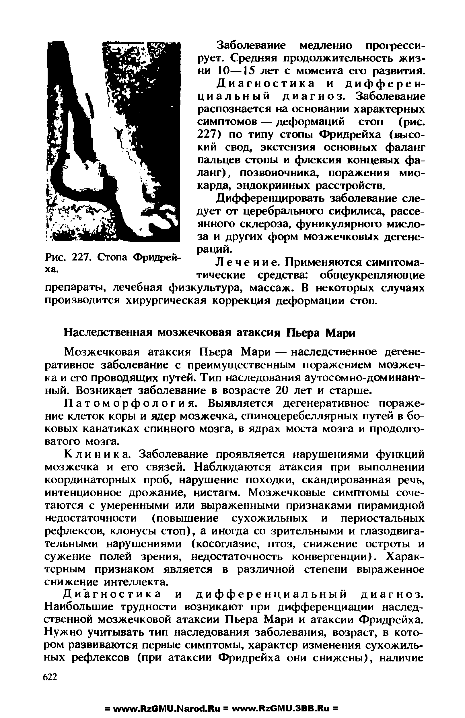 Рис. 227. Стопа Фридрейха. раций. Лечение. Применяются симптоматические средства общеукрепляющие...