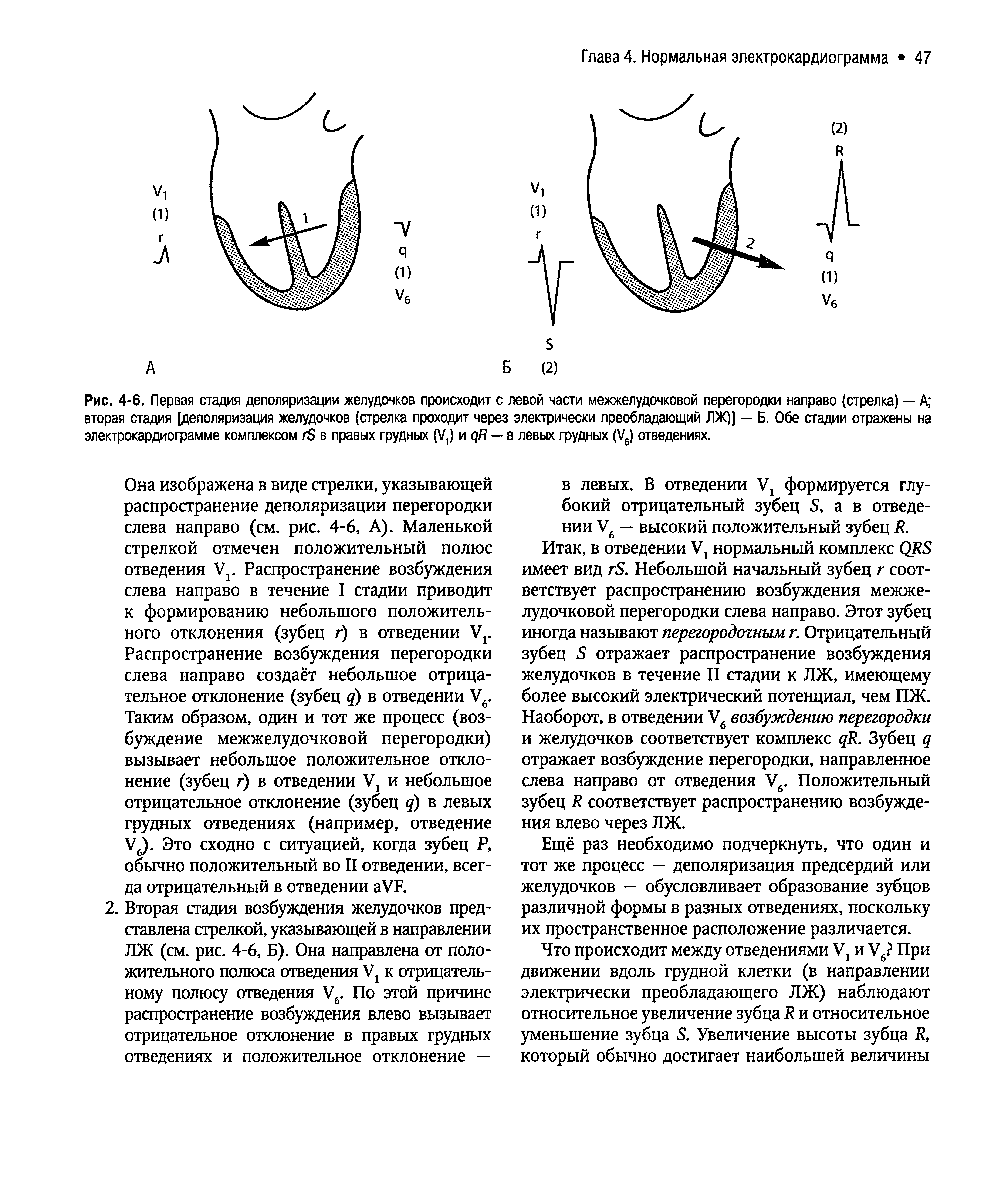 Рис. 4-6. Первая стадия деполяризации желудочков происходит с левой части межжелудочковой перегородки направо (стрелка) — А вторая стадия [деполяризация желудочков (стрелка проходит через электрически преобладающий ЛЖ)] — Б. Обе стадии отражены на электрокардиограмме комплексом гБ в правых грудных (У и дЯ — в левых грудных (У6) отведениях.