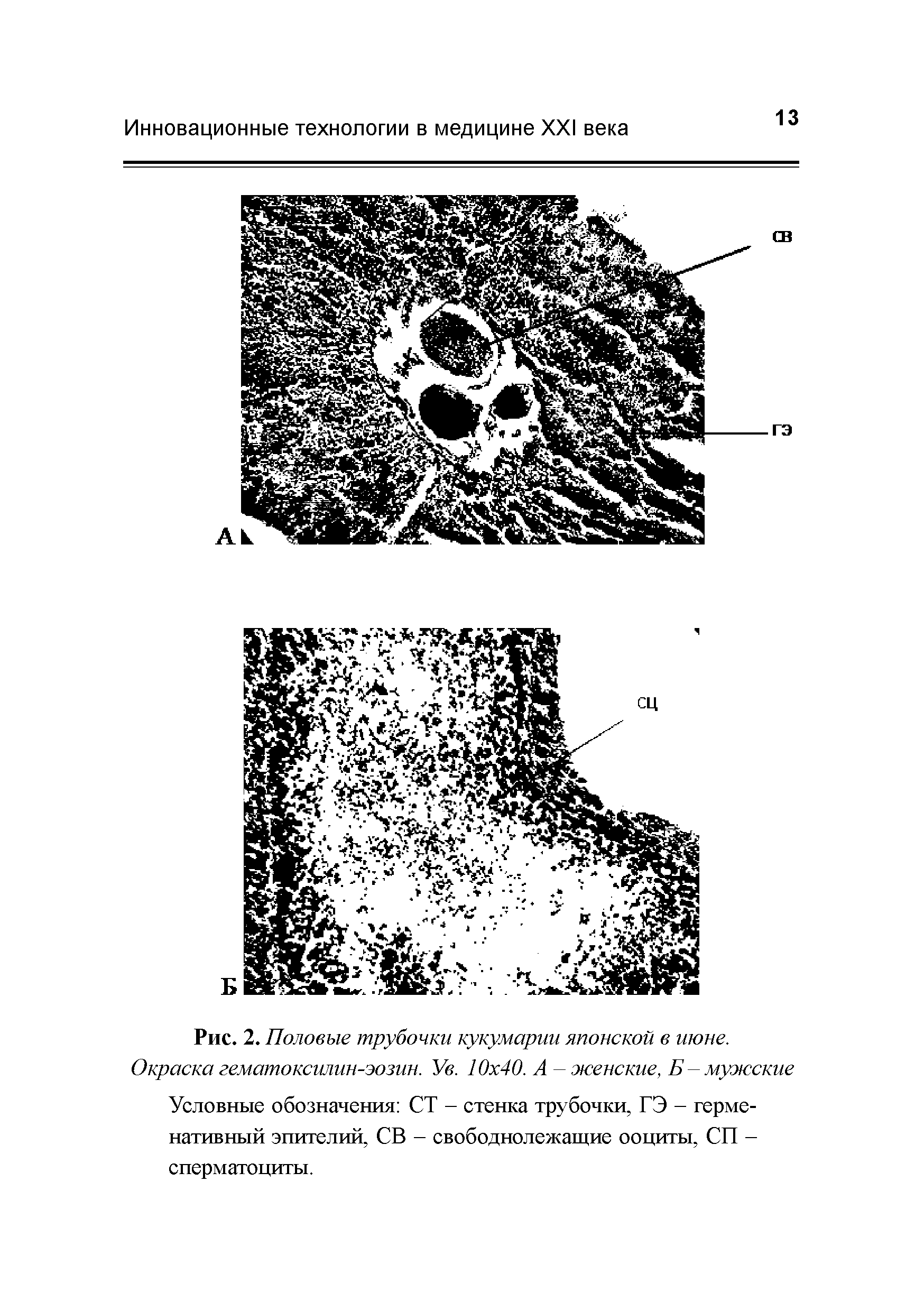 Рис. 2. Половые трубочки кукумарии японской в июне. Окраска гематоксилин-эозин. Ув. 10 40. А - женские, Б-мужские Условные обозначения СТ - стенка трубочки, ГЭ - герме-нативный эпителий, СВ - свободнолежащие ооциты, СП -сперматоциты.