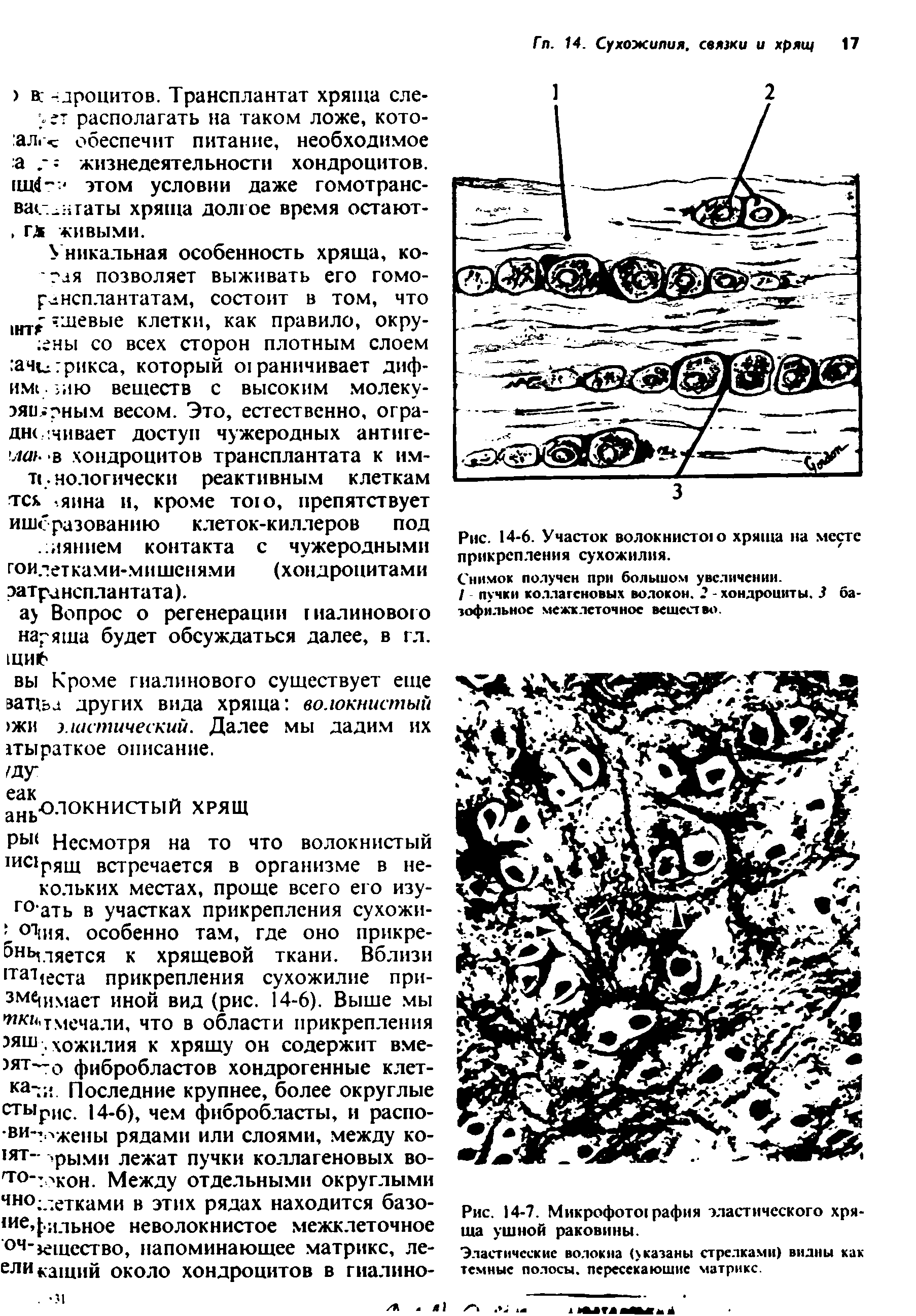 Рис. 14-7. Микрофото рафия эластического хряща ушной раковины.