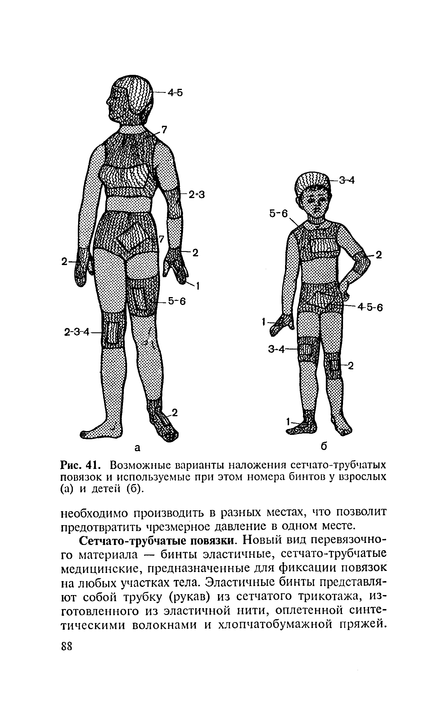 Рис. 41. Возможные варианты наложения сетчато-трубчатых повязок и используемые при этом номера бинтов у взрослых (а) и детей (б).