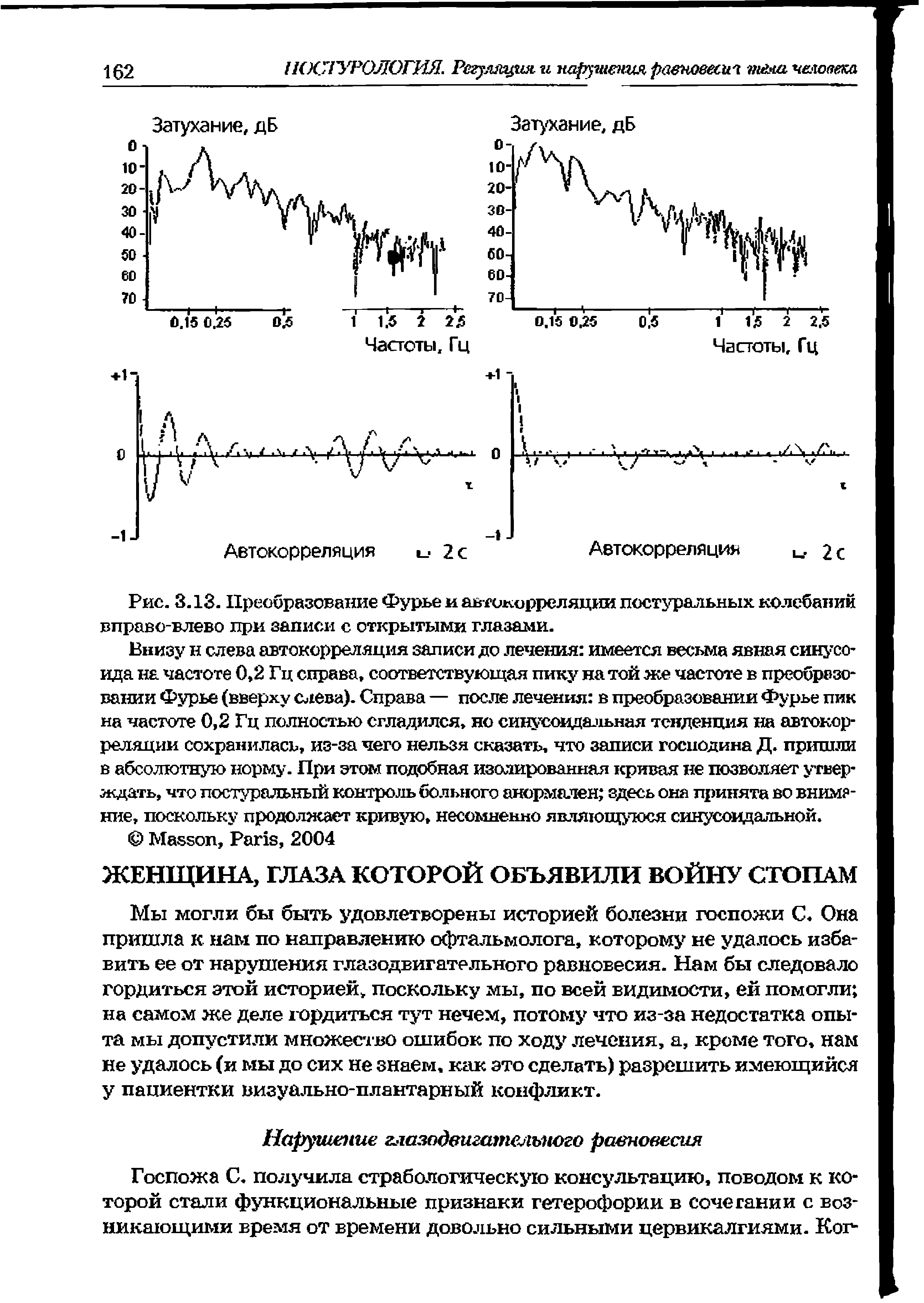 Рис. 3.13. Преобразование Фурье и автокорреляции постуральных колебании вправо-влево при записи с открытыми глазами.