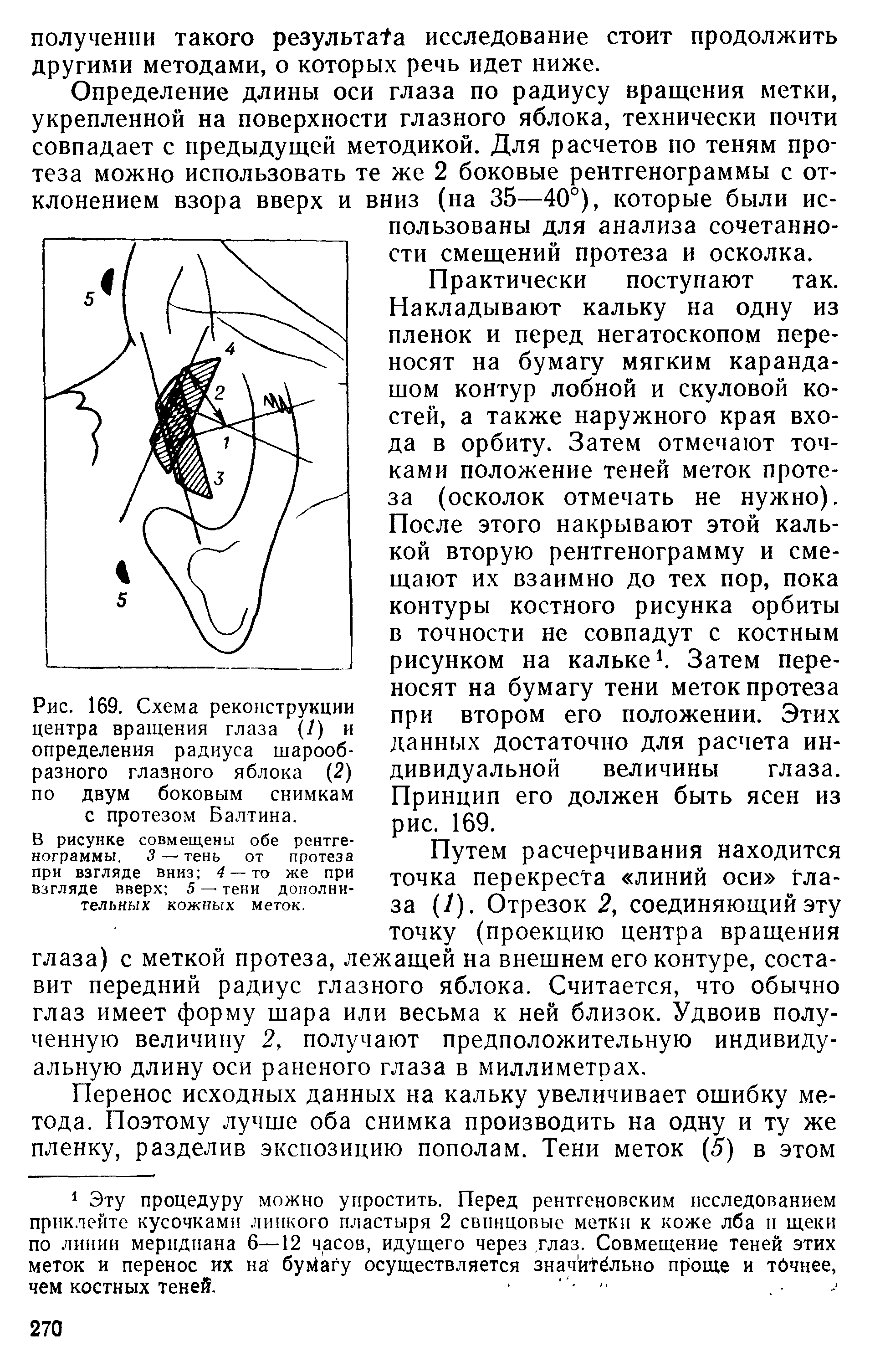 Рис. 169. Схема реконструкции центра вращения глаза (/) и определения радиуса шарообразного глазного яблока (2) по двум боковым снимкам с протезом Балтина.