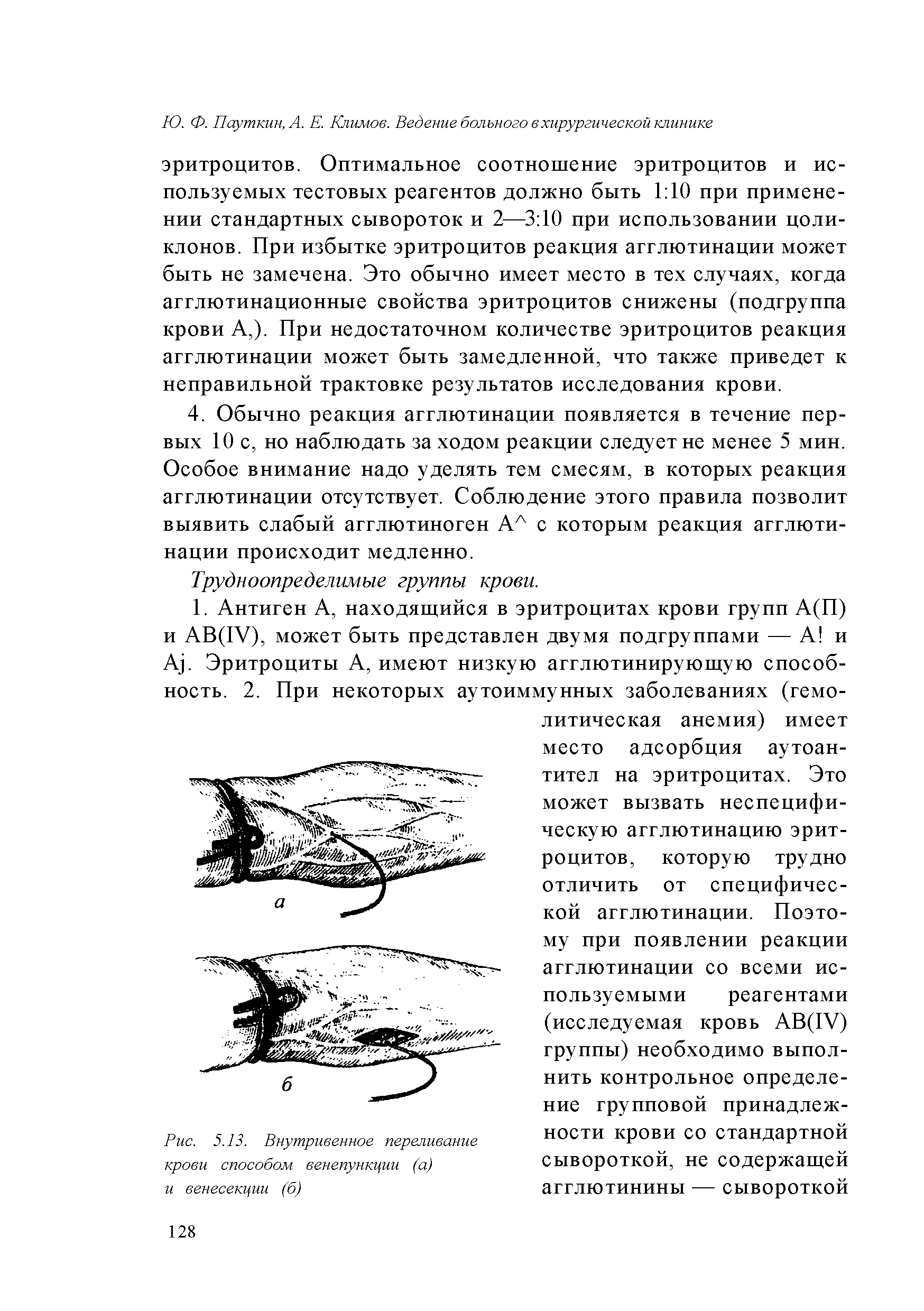 Рис. 5.13. Внутривенное переливание крови способом венепункции (а) и венесекции (б)...