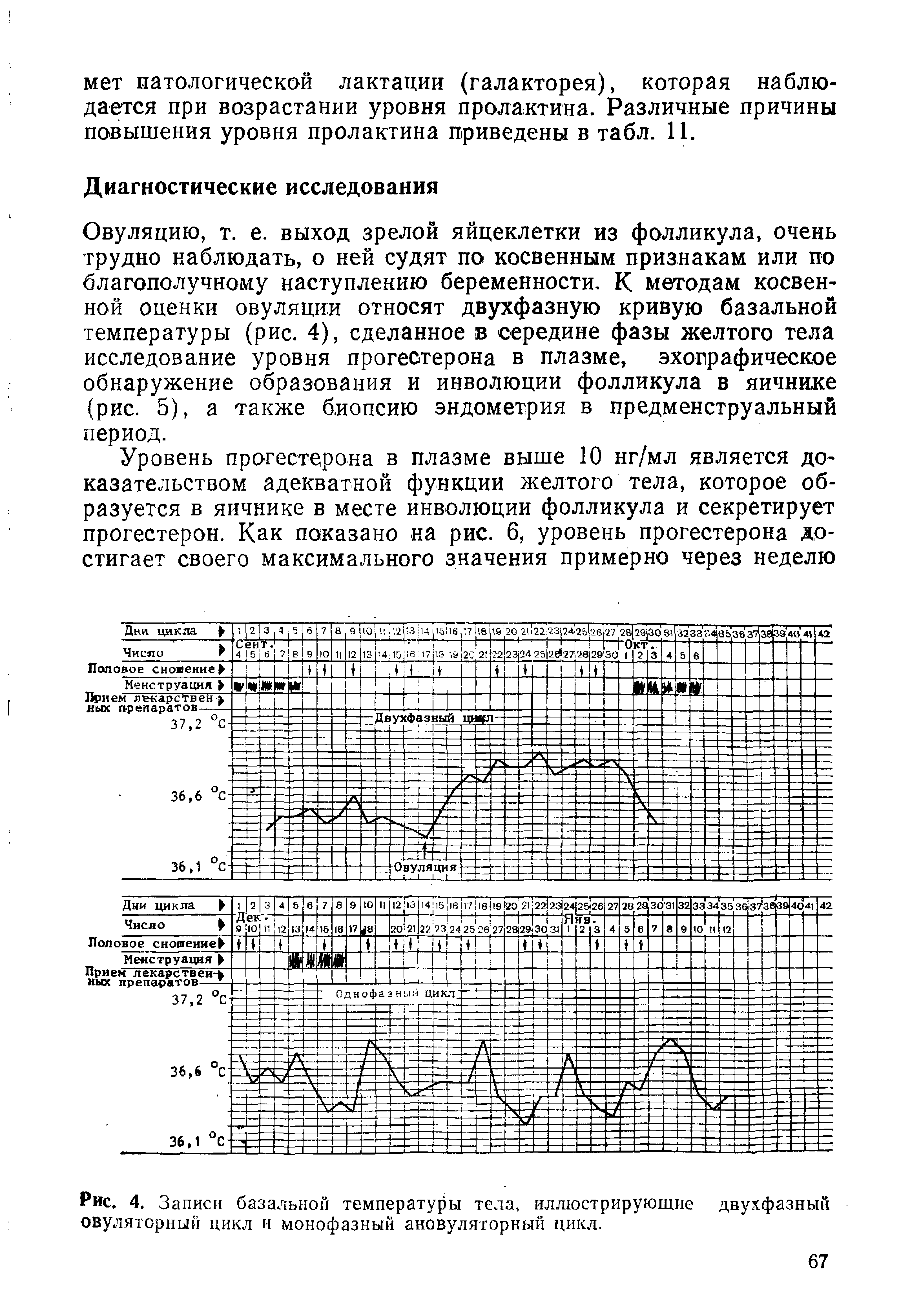 Рис. 4. Записи базальной температуры тела, иллюстрирующие двухфазный овуляторный цикл и моно фазный ановуляторный цикл.