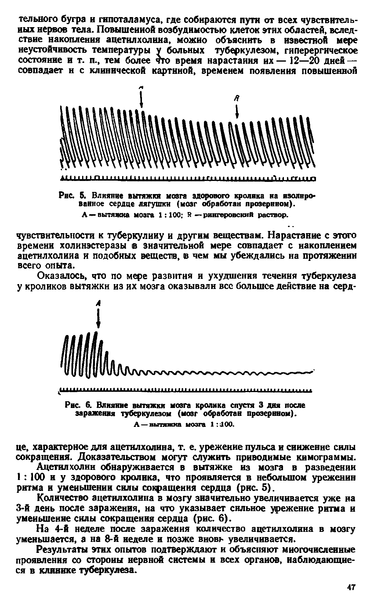 Рис. 6. Влияние вытяжки мозга кролика спустя 3 дня после заражения туберкулезом (мозг обработан проэернном).