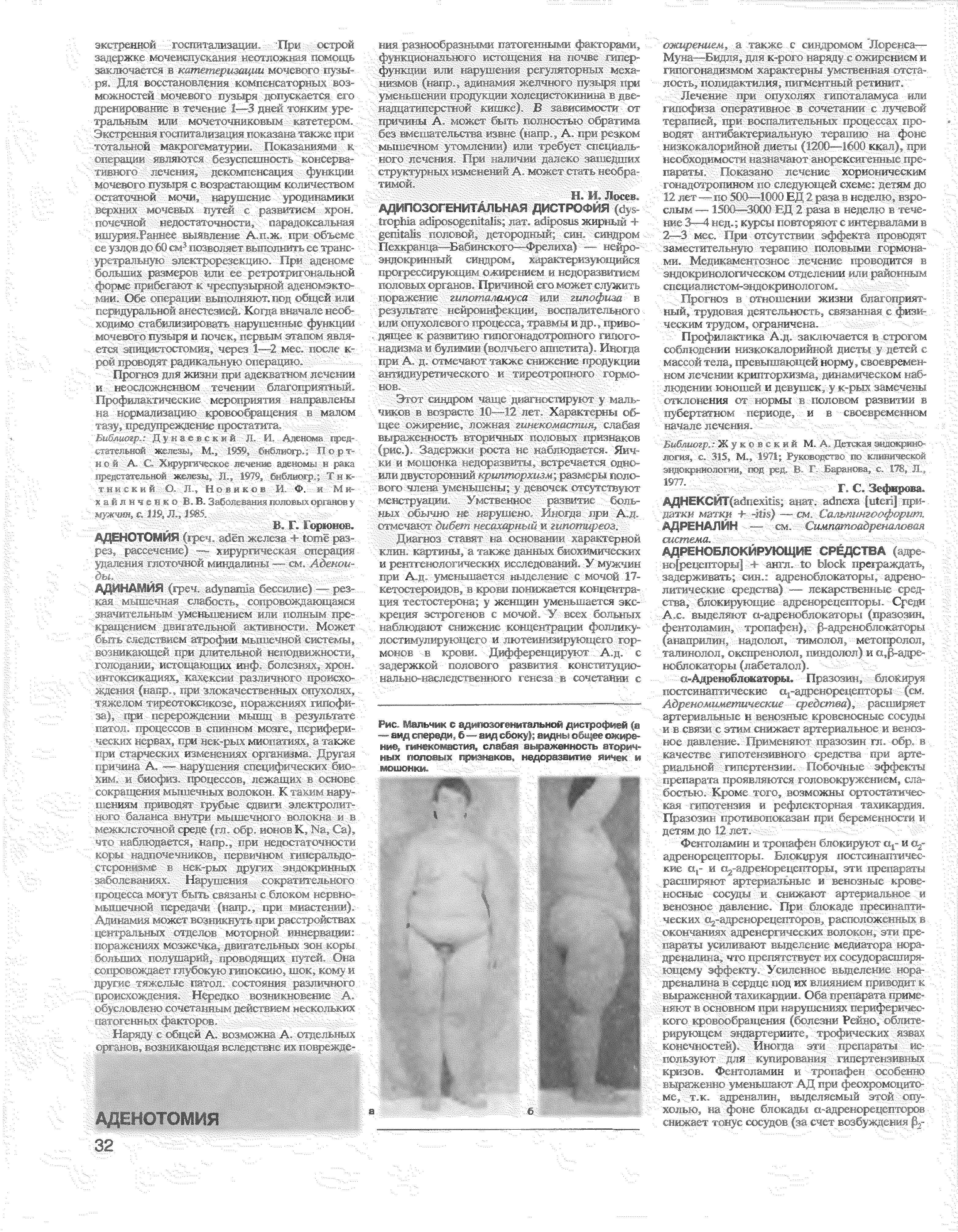 Рис. Мальчик с адипозогенитальной дистрофией (а — аид спереди, б—вид сбоку) ацдны общее ожирение, гинекомастия, слабая выраженность вторичных половых признаков, недоразвитие яичек и мошонки, ". -- -- ст --- с 3. 3 ст...