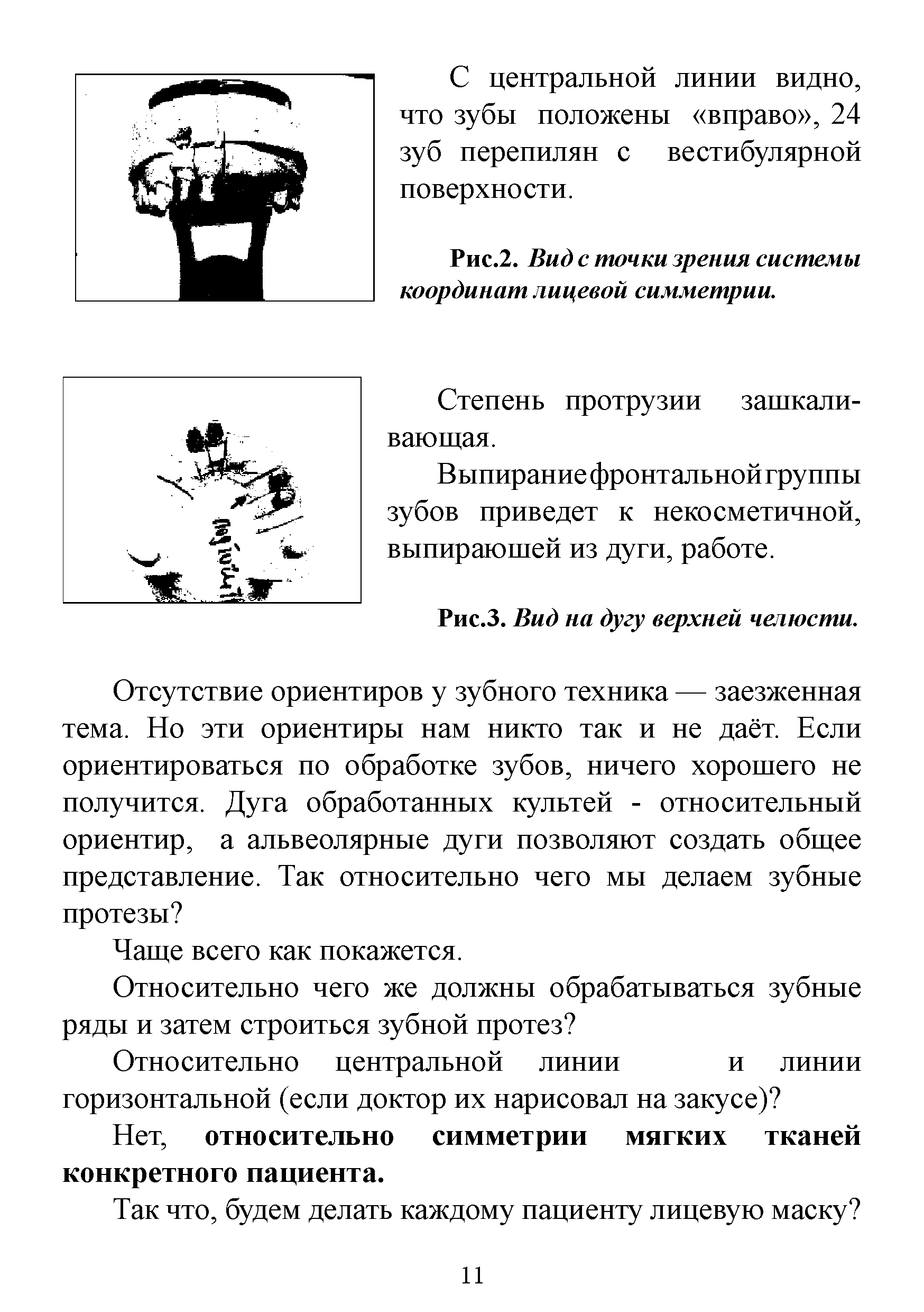 Рис.2. Вид с точки зрения системы координат лицевой симметрии.