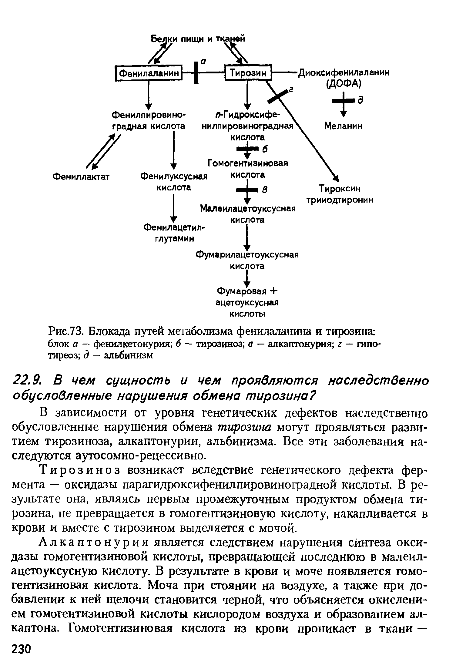 Рис.73. Блокада путей метаболизма фенилаланина и тирозина блок а — фенилкетонурия б — тирозиноз в — алкаптонурия г — гипотиреоз д — альбинизм...