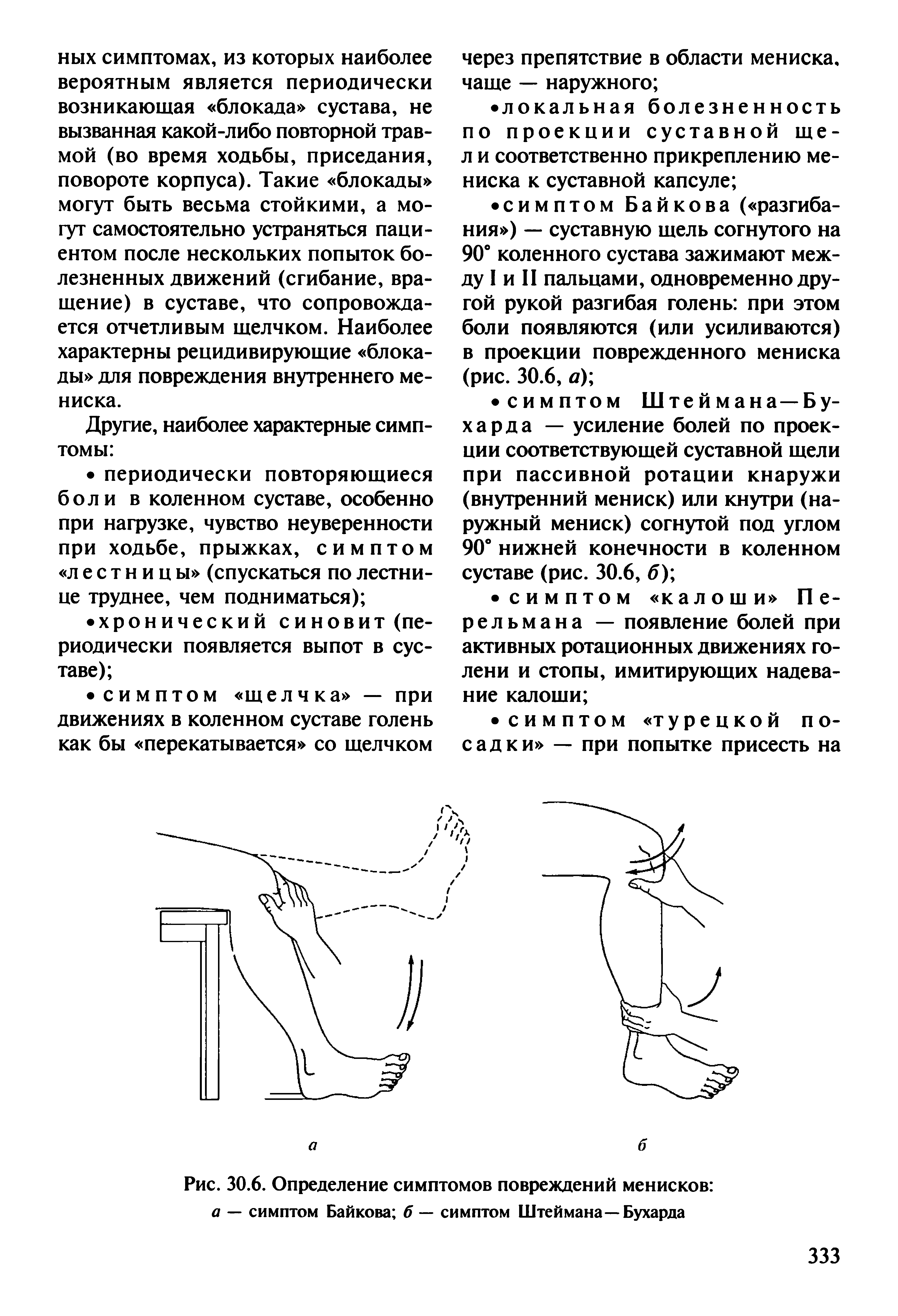 Рис. 30.6. Определение симптомов повреждений менисков а — симптом Байкова б — симптом Штеймана—Бухарда...