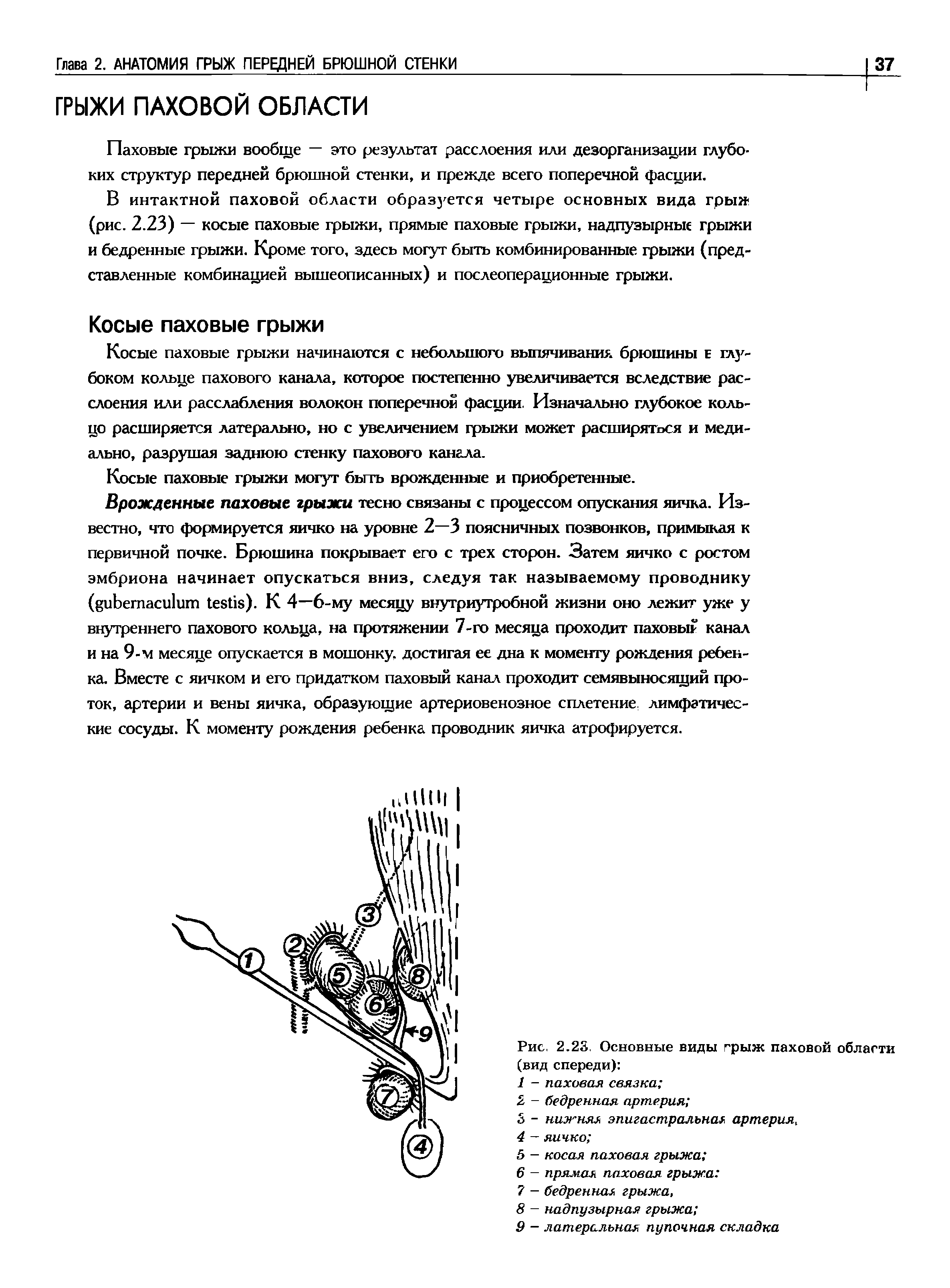 Рис. 2.23. Основные виды грыж паховой области (вид спереди) ...