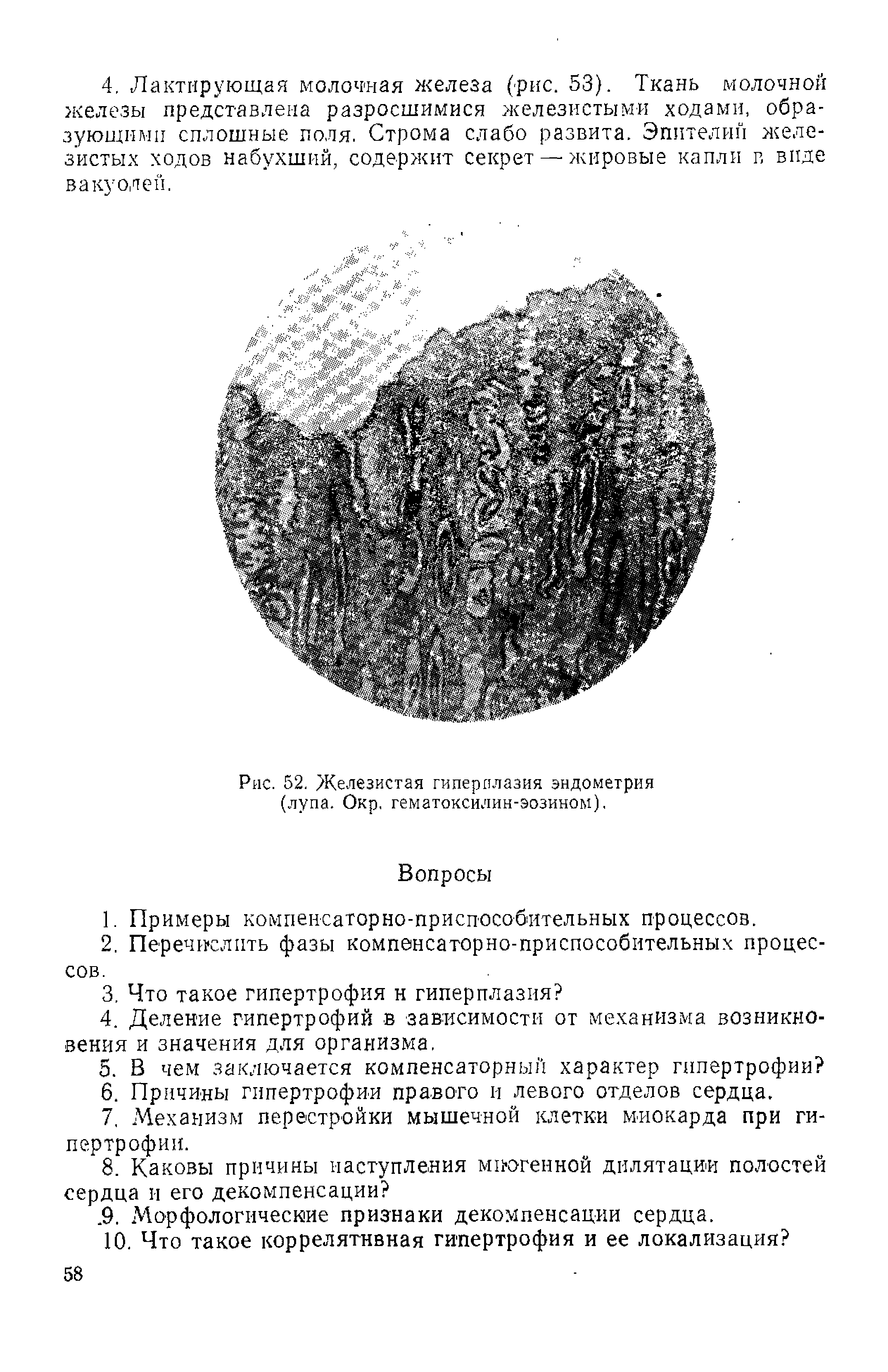 Рис. 52. Железистая гиперплазия эндометрия (лупа. Окр. гематоксилин-эозином).