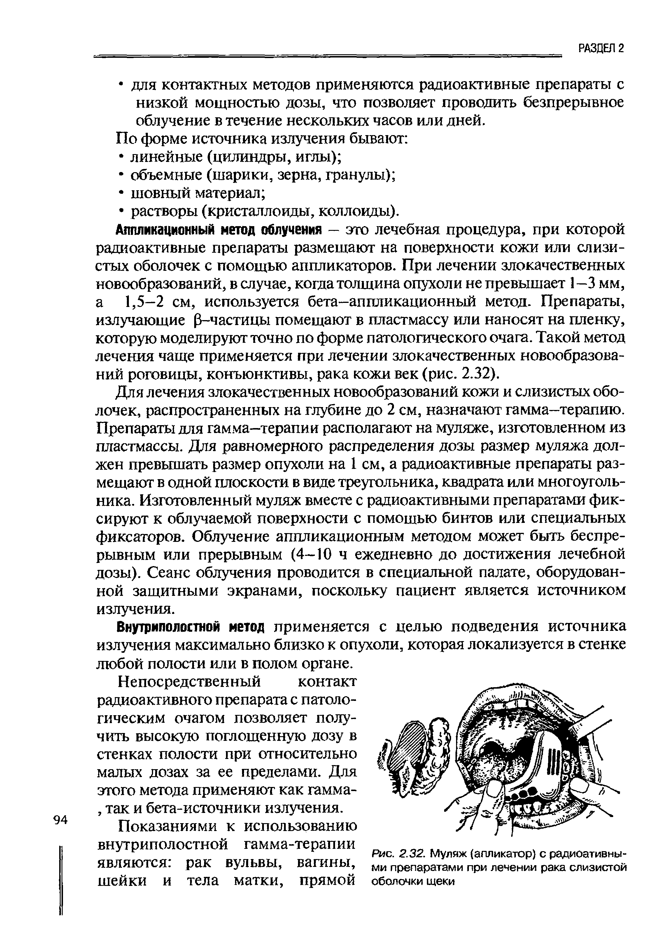 Рис. 2.32. Муляж (апликатор) с радиоативны-ми препаратами при лечении рака слизистой оболочки щеки...