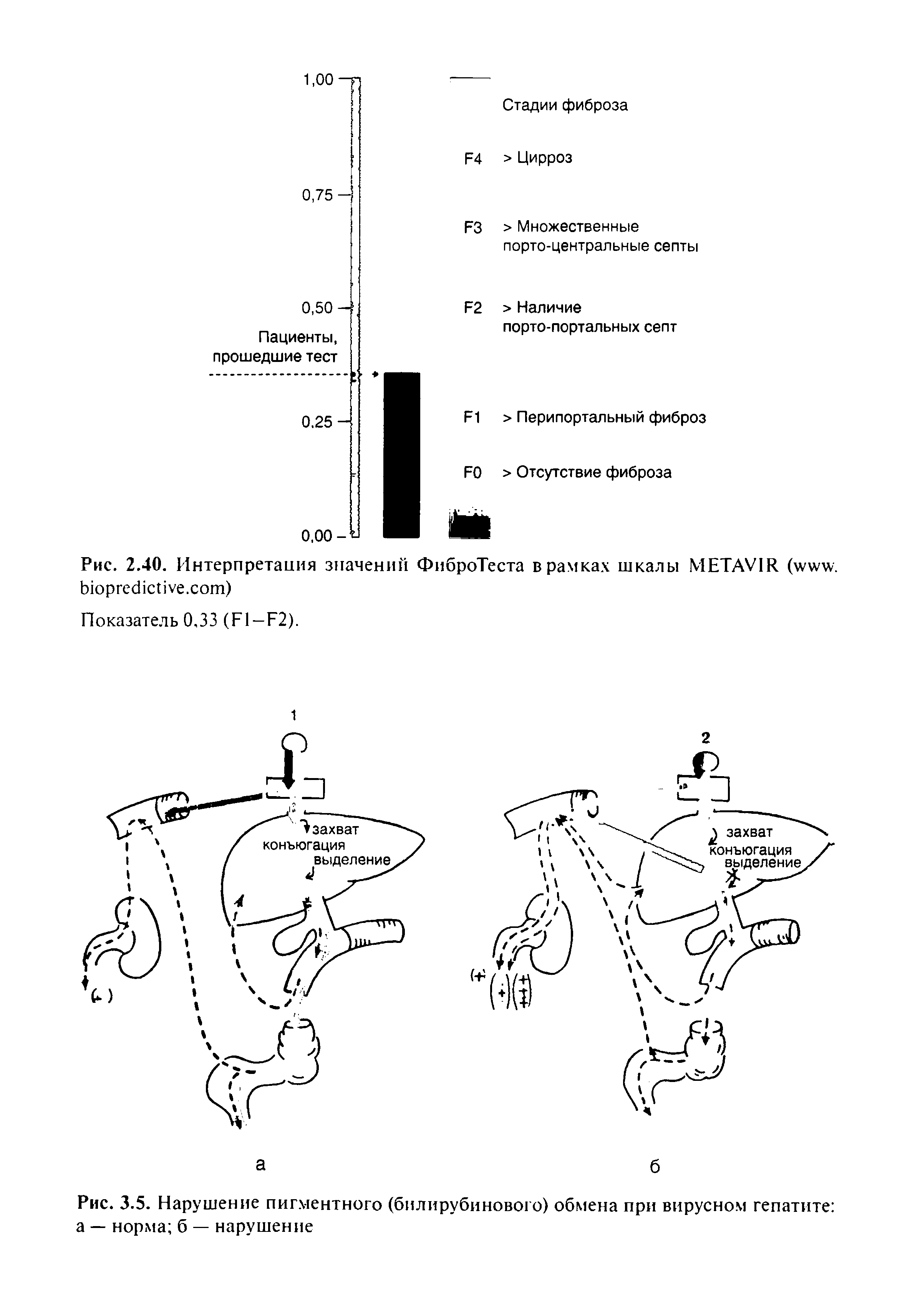 Рис. 2.40. Интерпретация значений ФиброТеста в рамках шкалы METAV1R ( . . )...