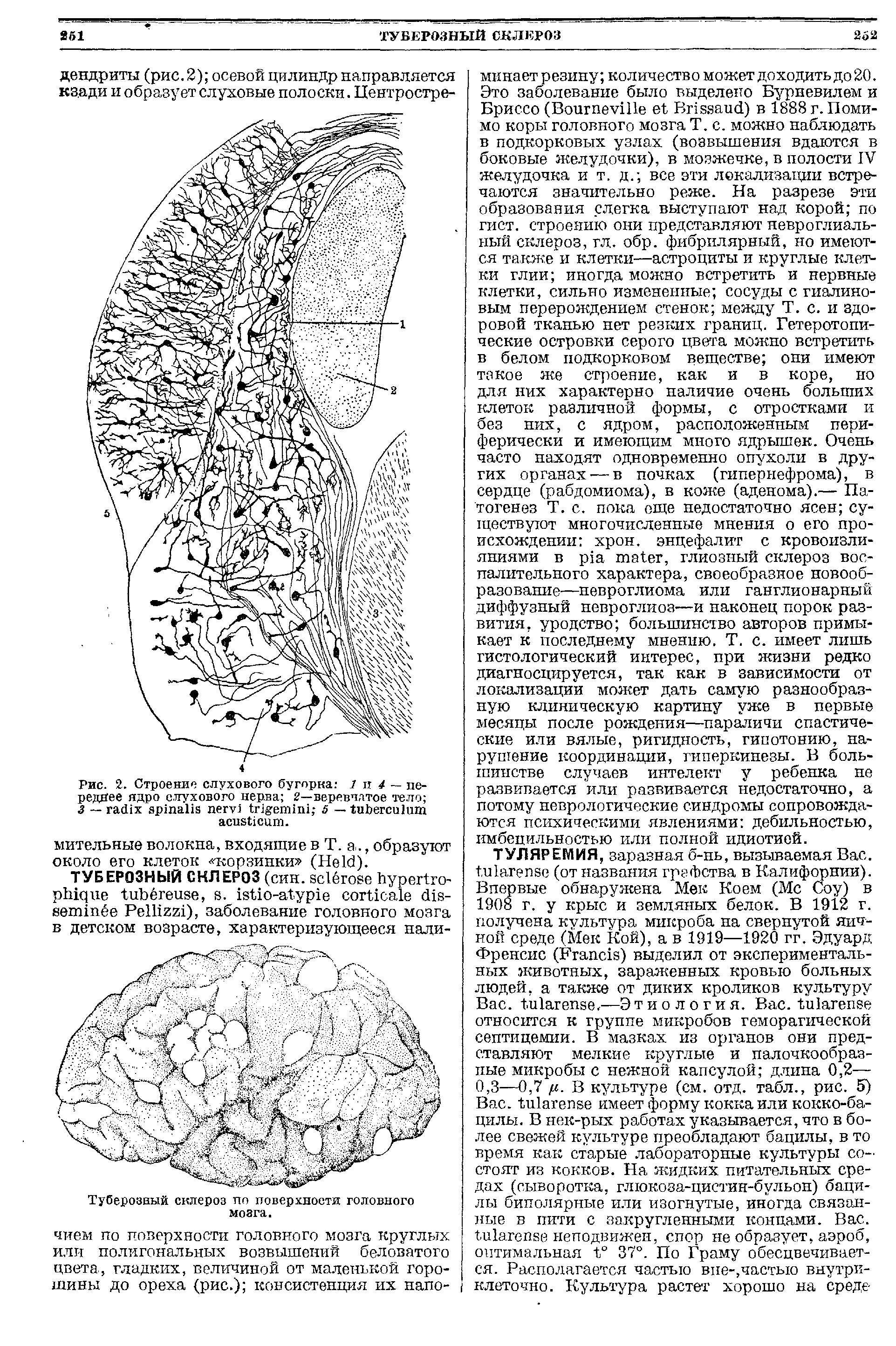 Рис. 2. Строение слухового бугорка. 1 и 4 — переднее ядро слухового нерва 2—веревчлтое тело 3 — 5 — .