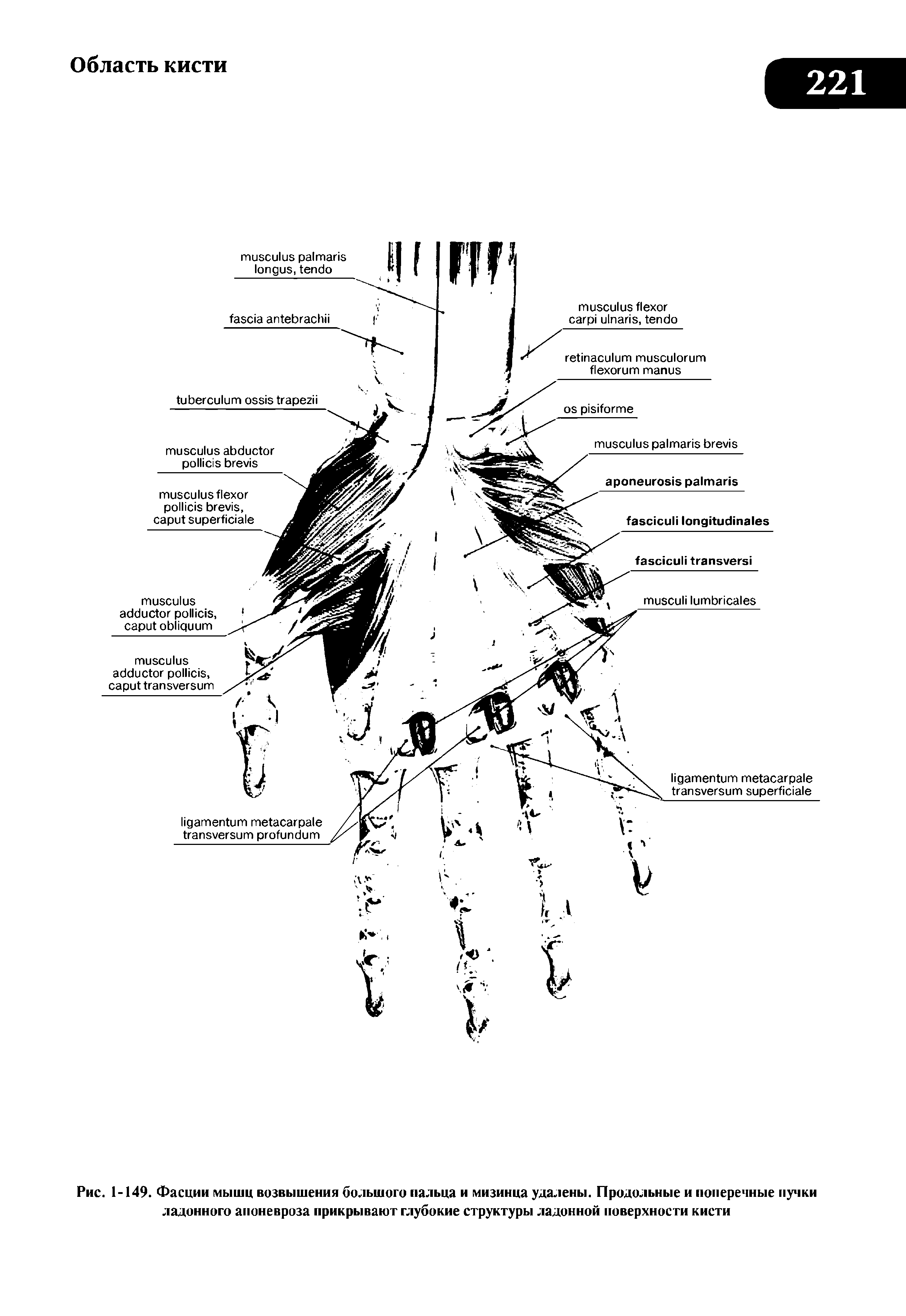 Рис. 1-149. Фасции мышц возвышения большого пальца и мизинца удалены. Продольные и поперечные пучки ладонного апоневроза прикрывают глубокие структуры ладонной поверхности кисти...