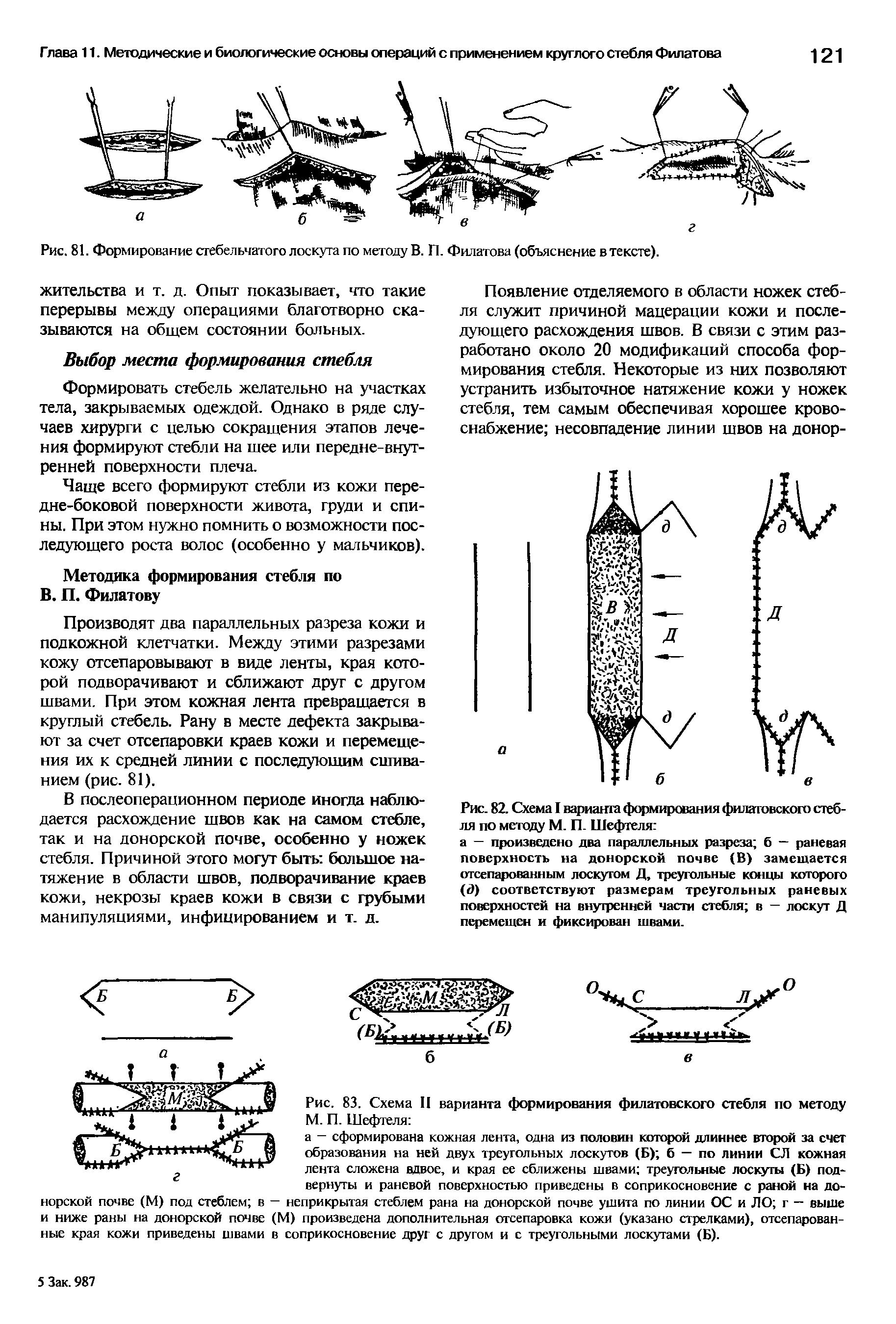 Рис. 82. Схема I варианта формирования филатовского стебля по методу М. П. Шефтеля ...