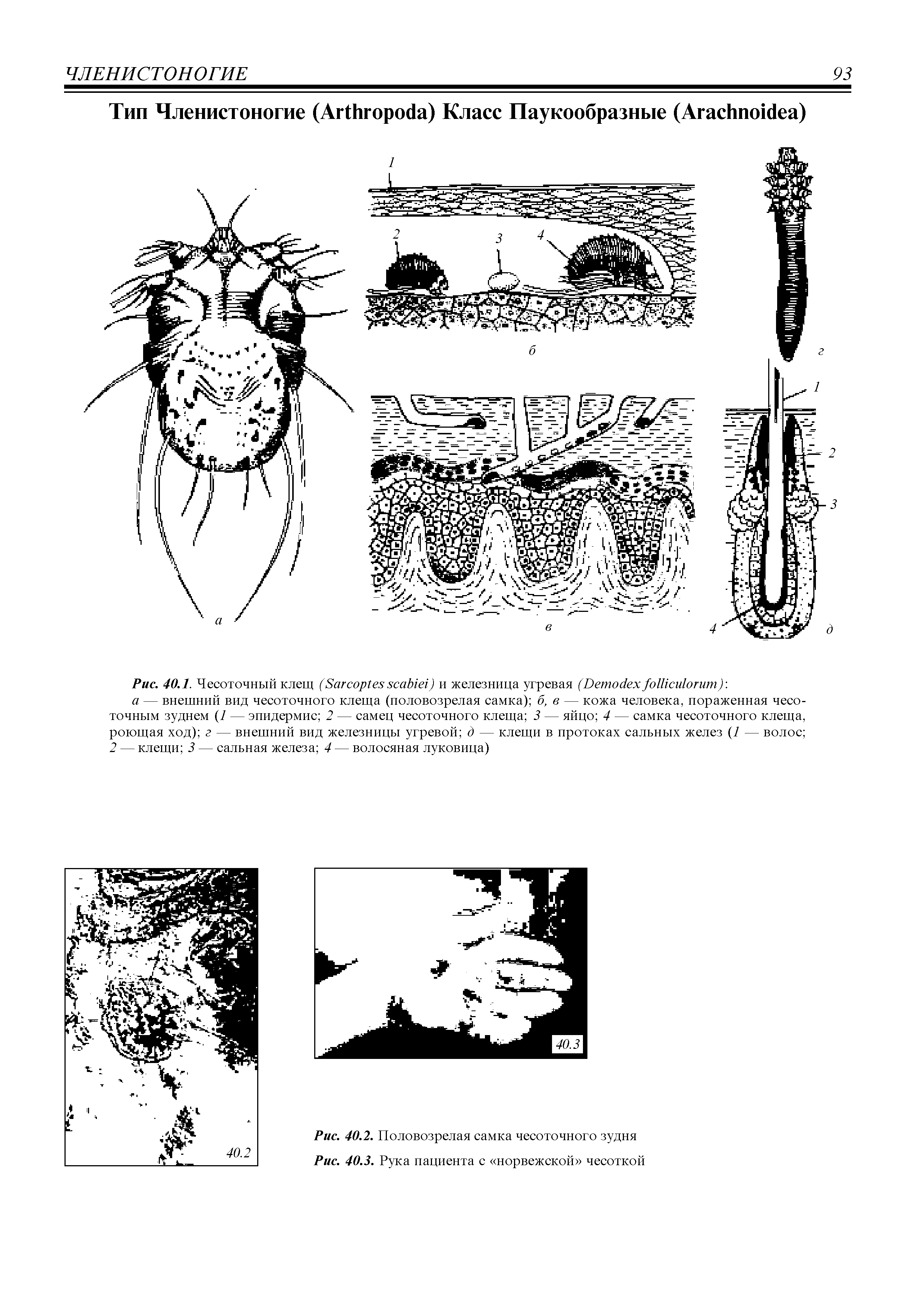 Рис. 40.1. Чесоточный клещ (S ) и железница угревая (D ) ...