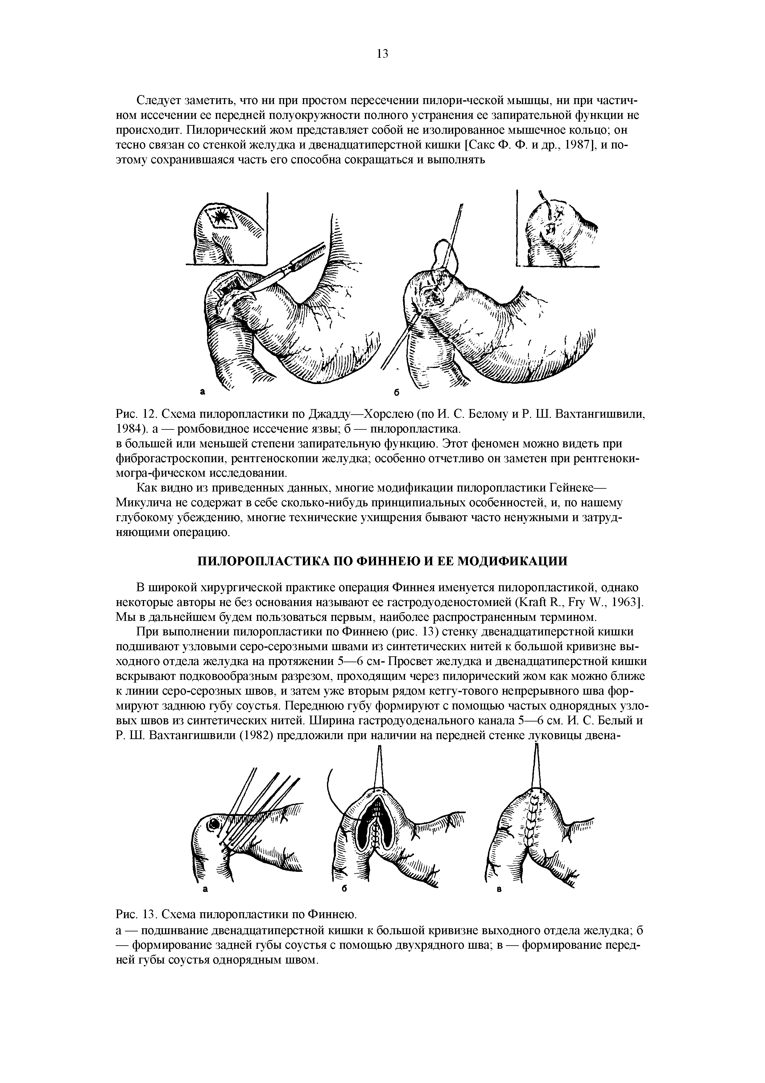 Рис. 12. Схема пилоропластики по Джадду—Хорслею (по И. С. Белому и Р. Ш. Вахтангишвили, 1984). а — ромбовидное иссечение язвы б — пнлоропластика.