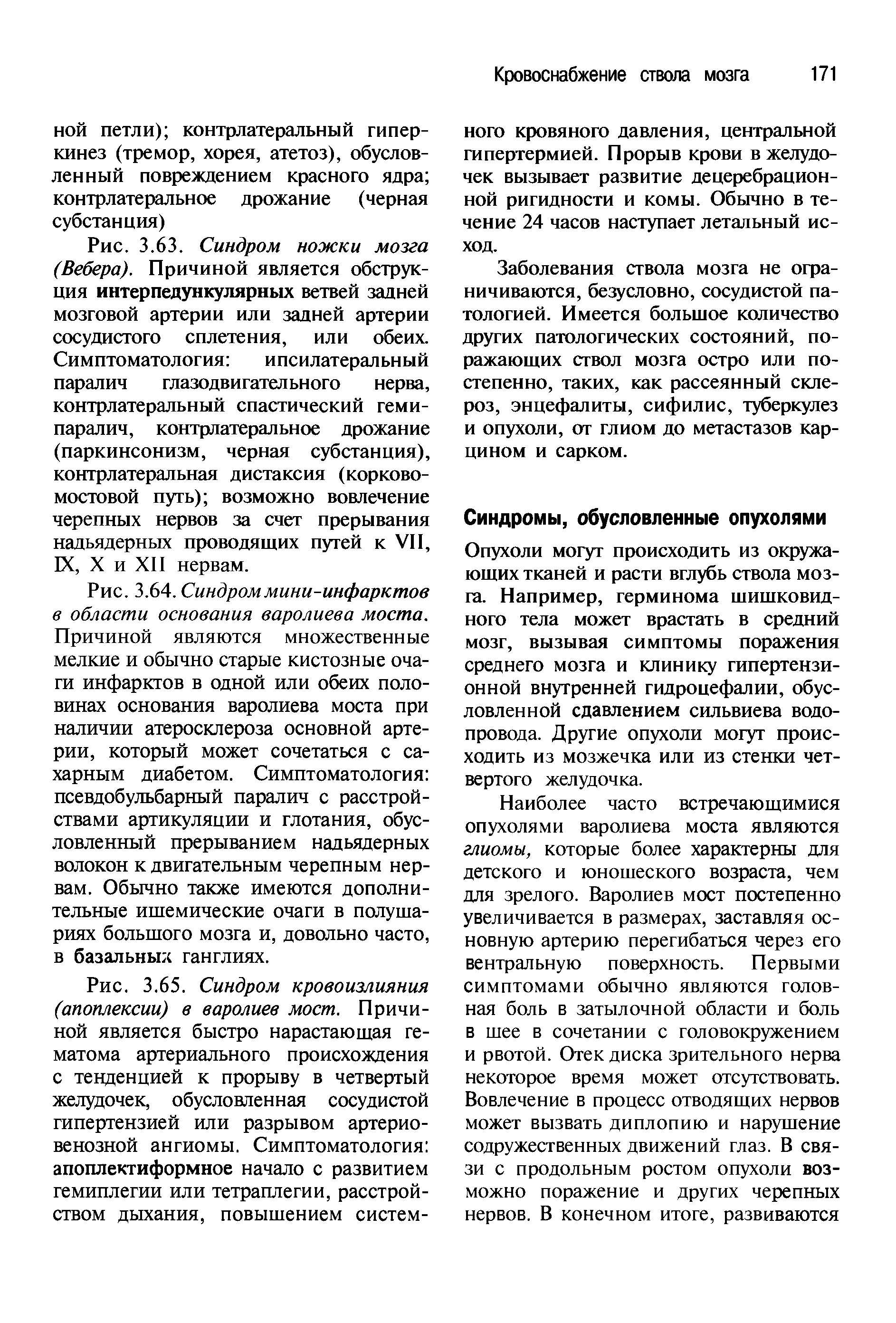 Рис. 3.63. Синдром ножки мозга (Вебера). Причиной является обструкция интерпедункулярных ветвей задней мозговой артерии или задней артерии сосудистого сплетения, или обеих. Симптоматология ипсилатеральный...