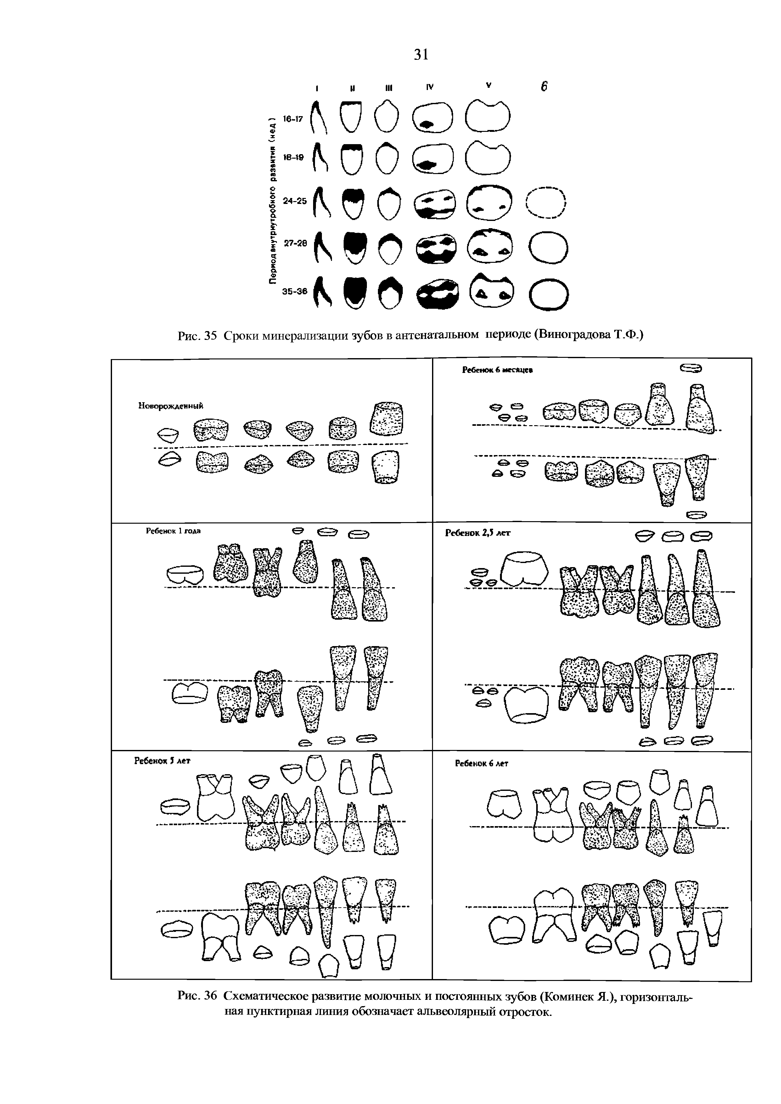 Рис. 35 Сроки минерализации зубов в антенатальном периоде (Виноградова Т.Ф.)...