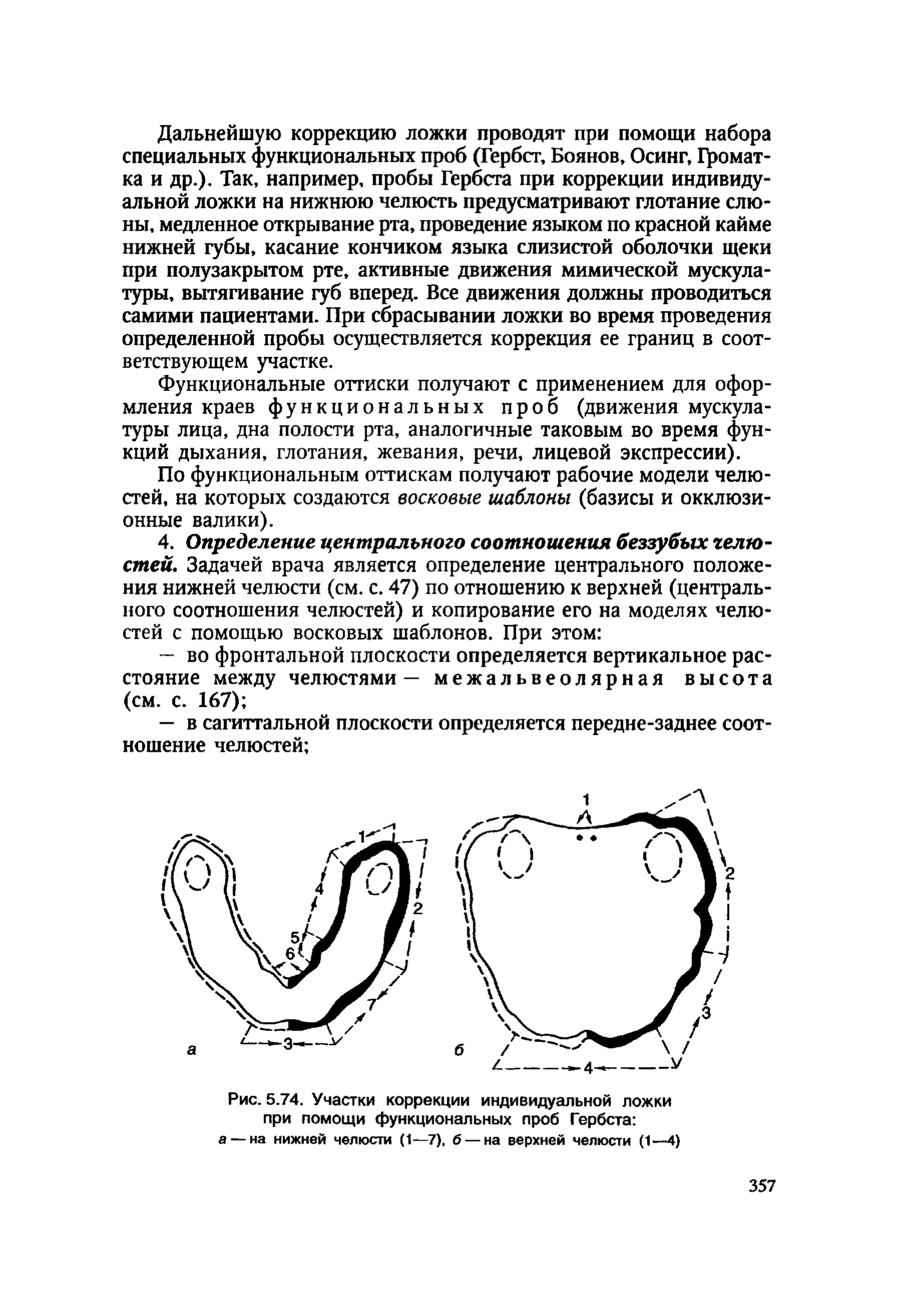 Рис. 5.74. Участки коррекции индивидуальной ложки при помощи функциональных проб Гербста а — на нижней челюсти (1—7), б — на верхней челюсти (1—4)...