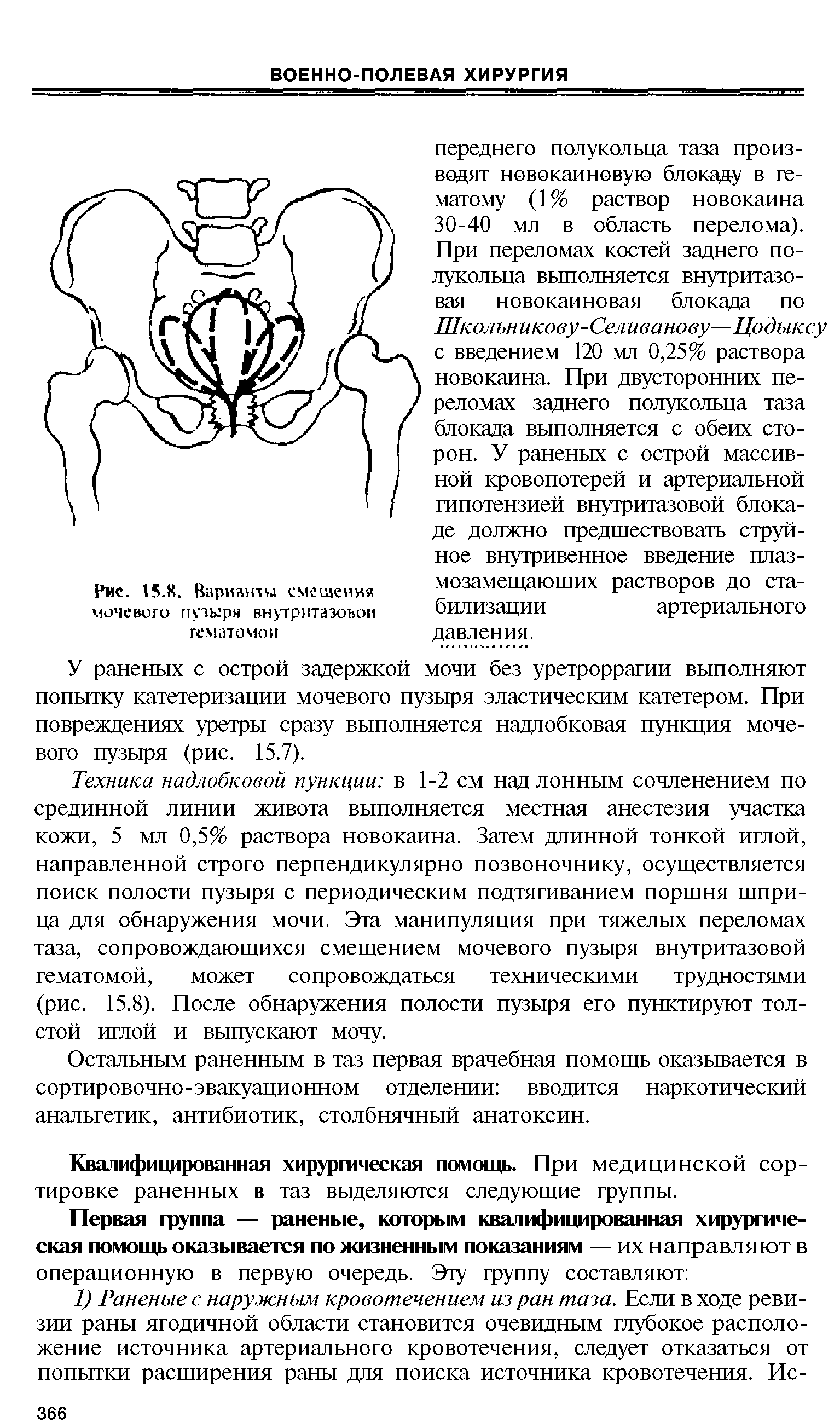 Рис. 15.. Варианты смешения мочевого пузыря внутритазовой гематомой...