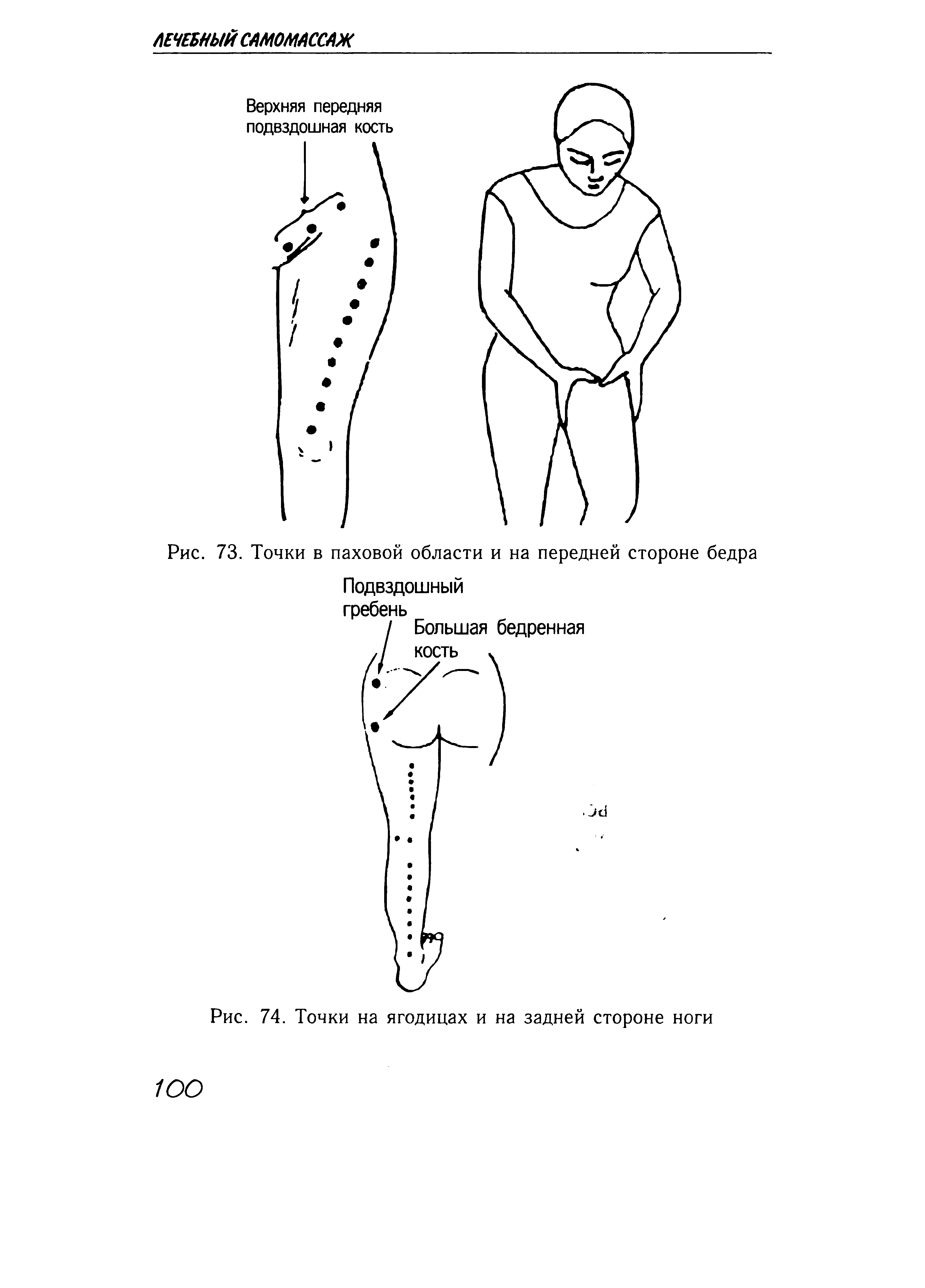 Рис. 73. Точки в паховой области и на передней стороне бедра...