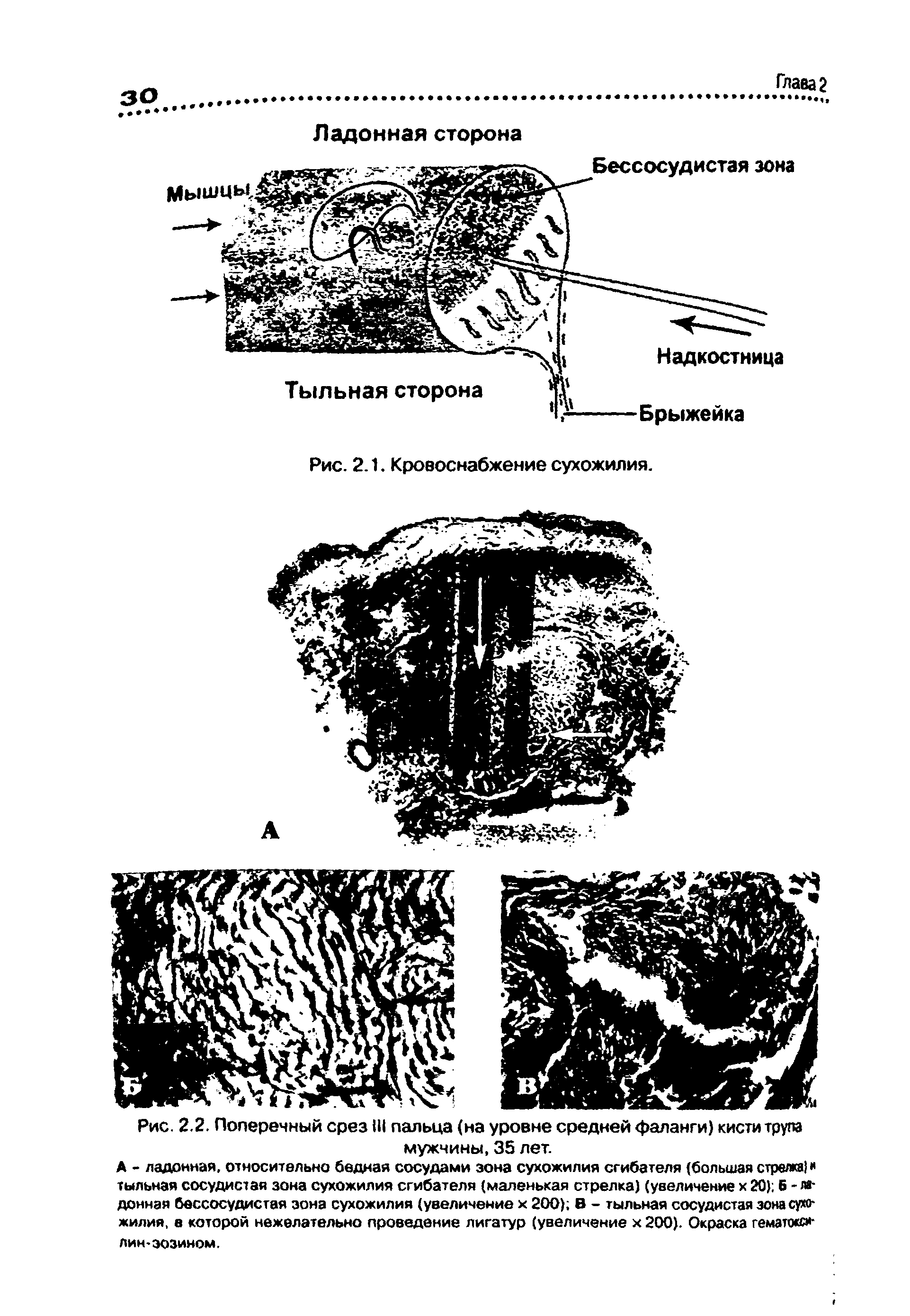 Рис. 2.2. Поперечный срез III пальца (на уровне средней фаланги) кисти трупа мужчины, 35 лет.