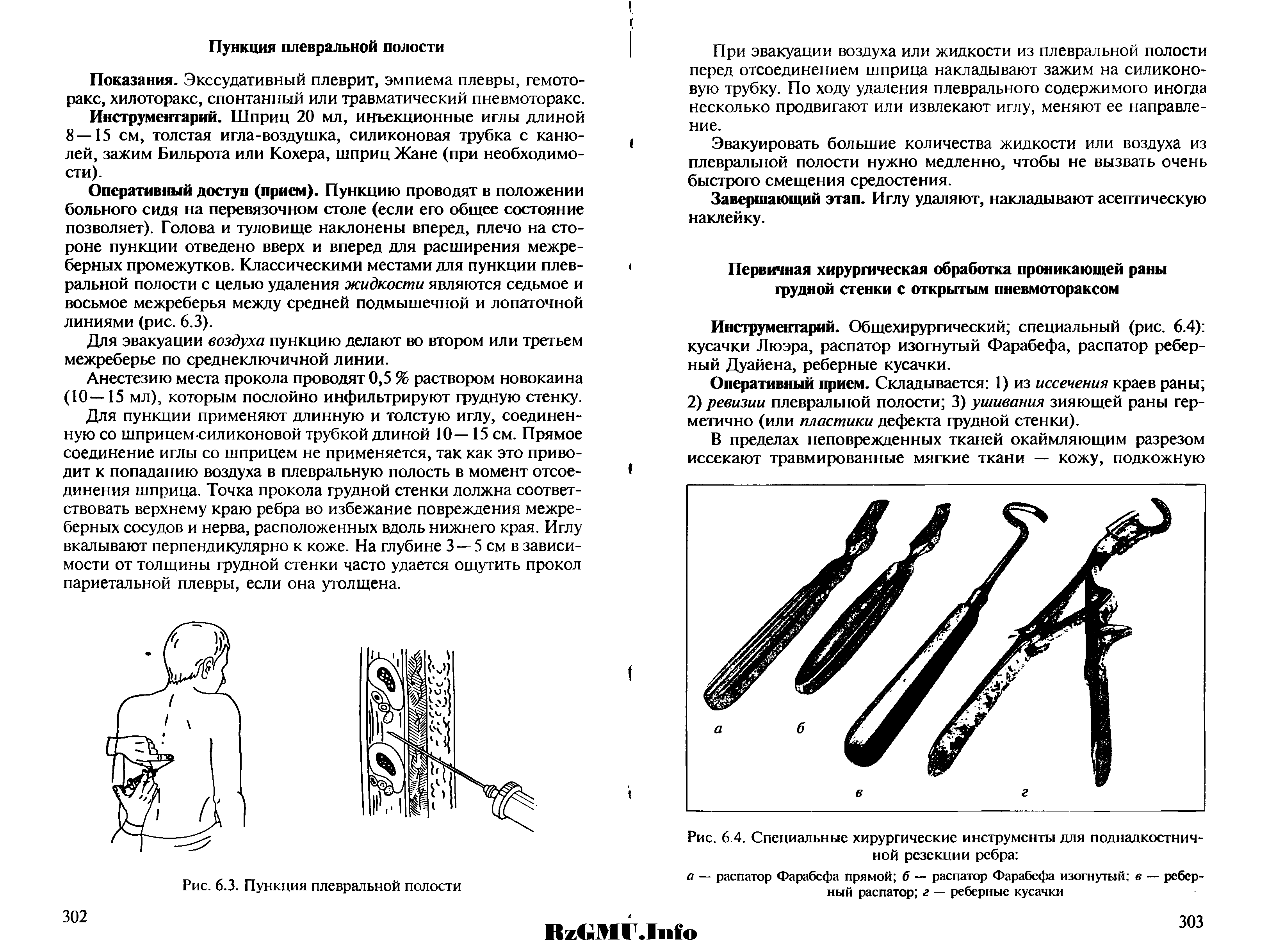 Рис. 6 4. Специальные хирургические инструменты для поднадкостничной резекции ребра ...