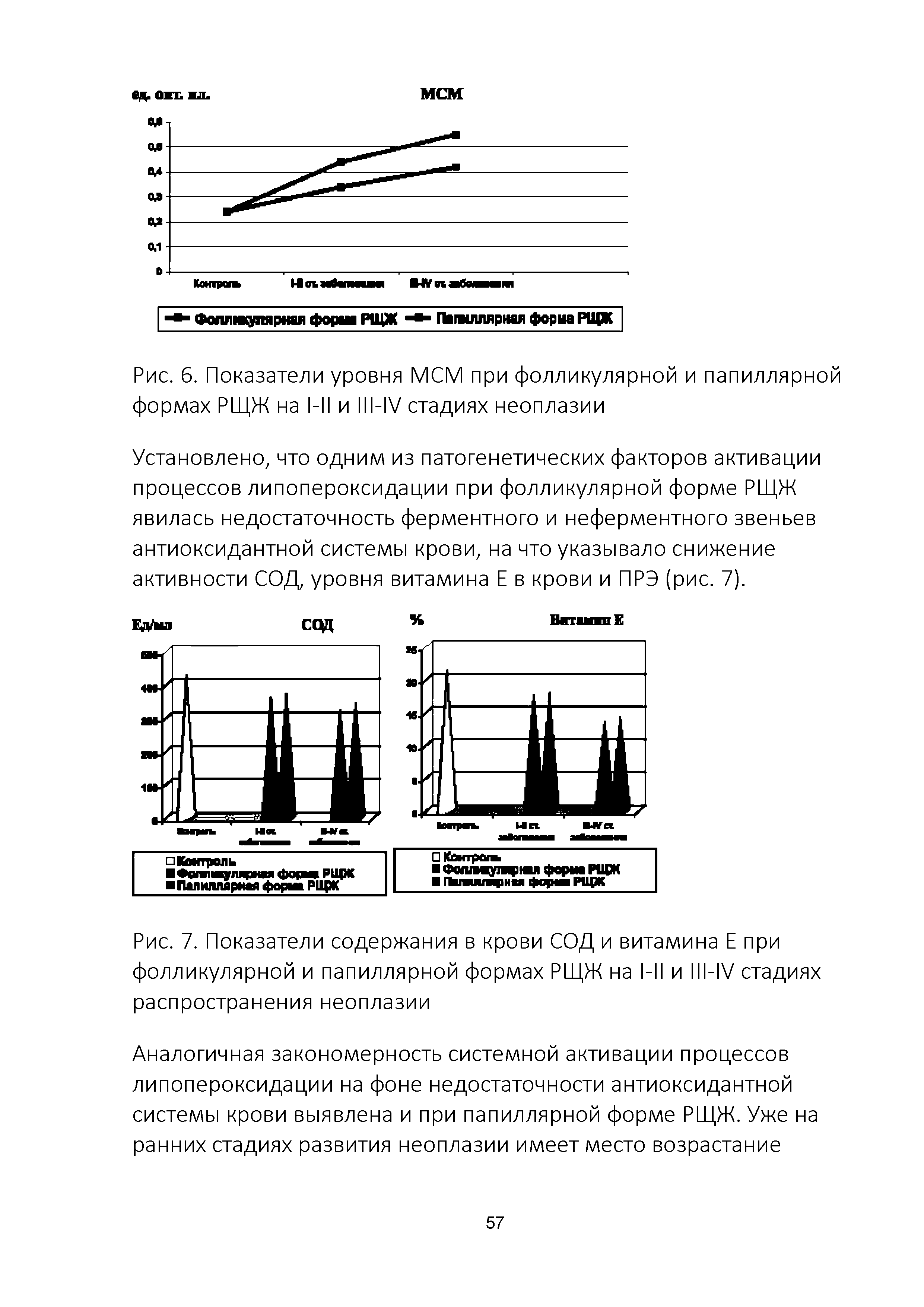 Рис. 7. Показатели содержания в крови СОД и витамина Е при фолликулярной и папиллярной формах РЩЖ на 1-11 и 111-1У стадиях распространения неоплазии...