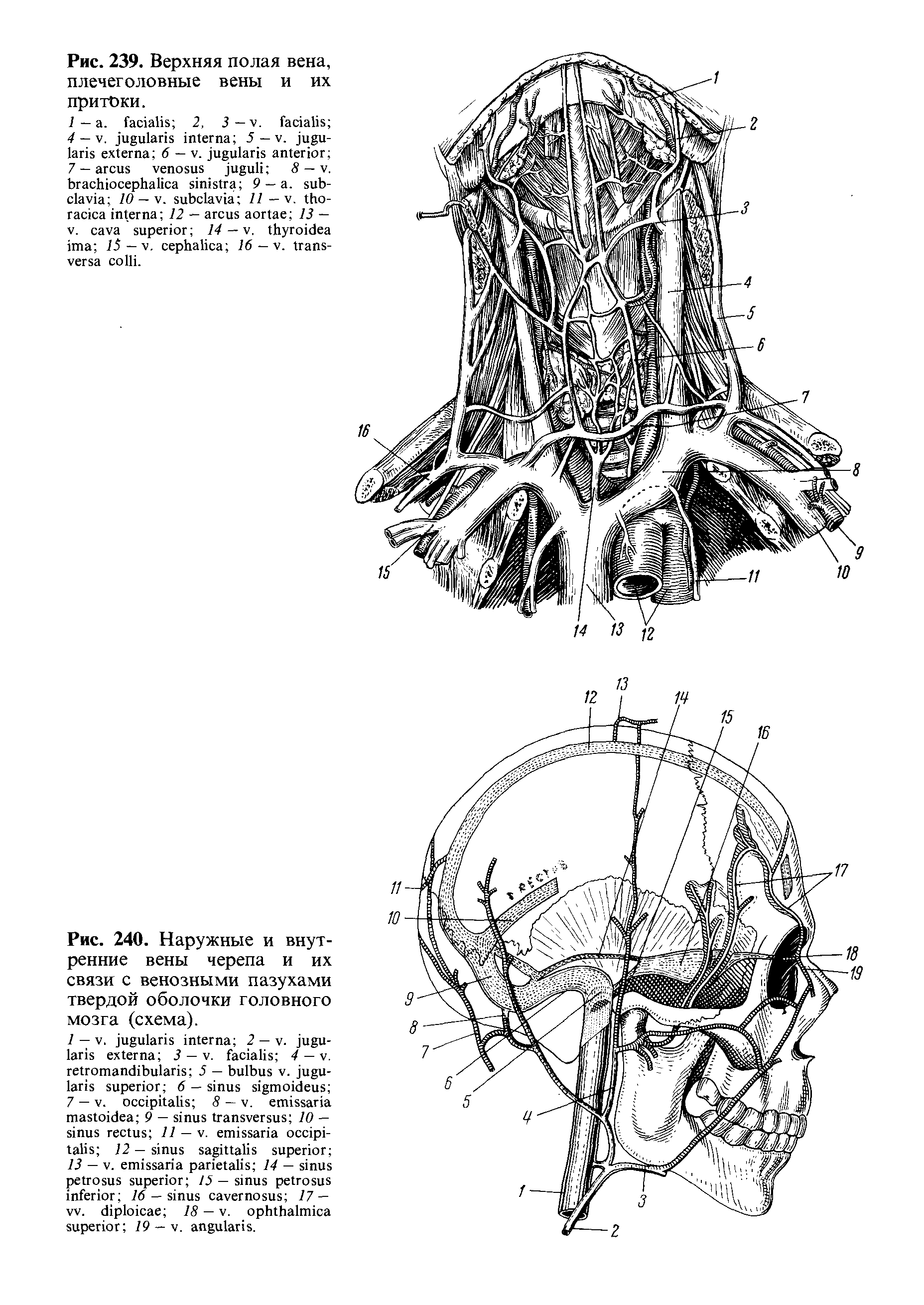 Рис. 240. Наружные и внутренние вены черепа и их связи с венозными пазухами твердой оболочки головного мозга (схема).