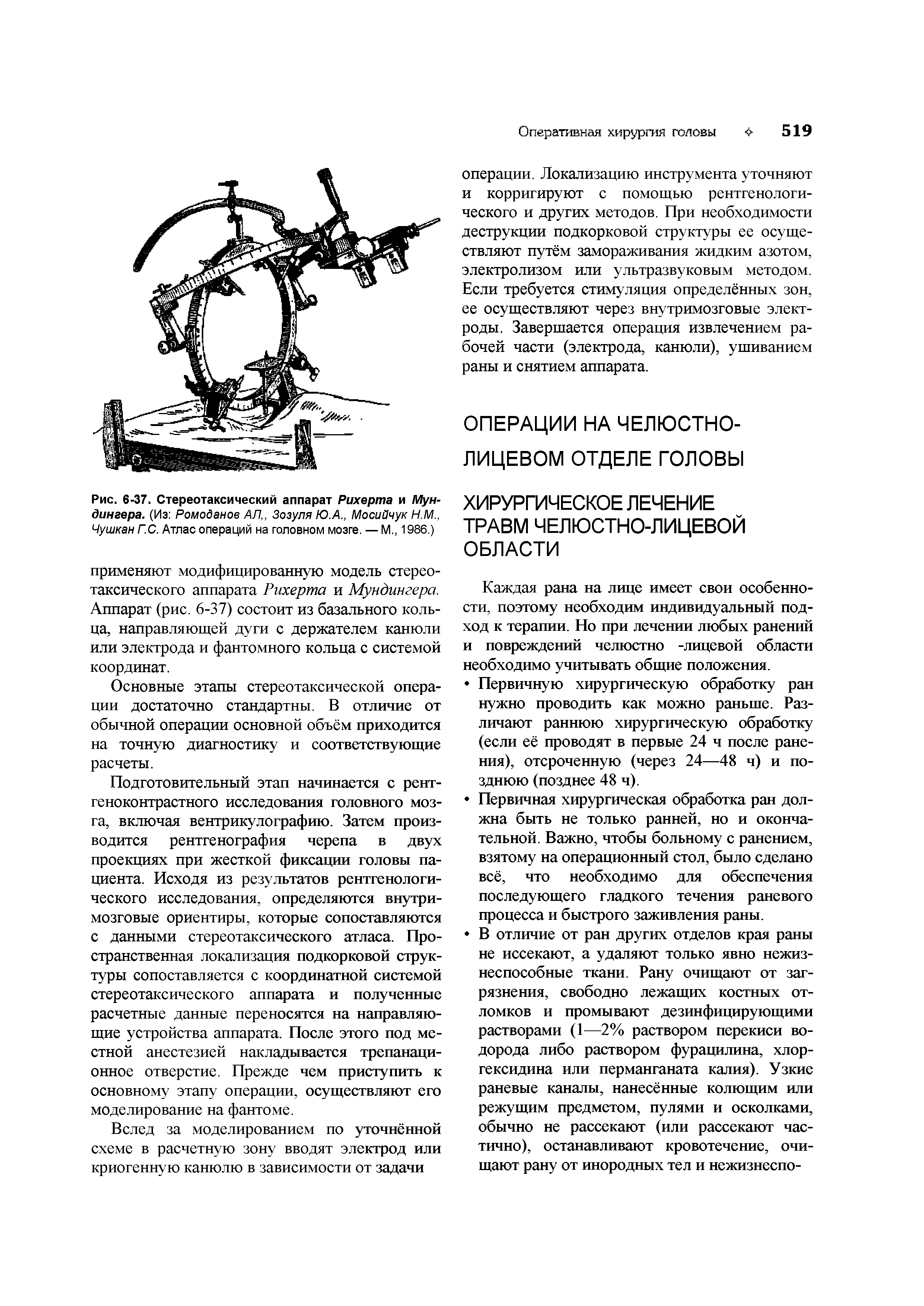 Рис. 6-37. Стереотаксический аппарат Рихерта и Мун-динаера. (Из Ромоданов АЛ, Зозуля Ю.А., Мосийчук Н.М., Чушкан Г.С. Атлас операций на головном мозге. — М., 1986.)...