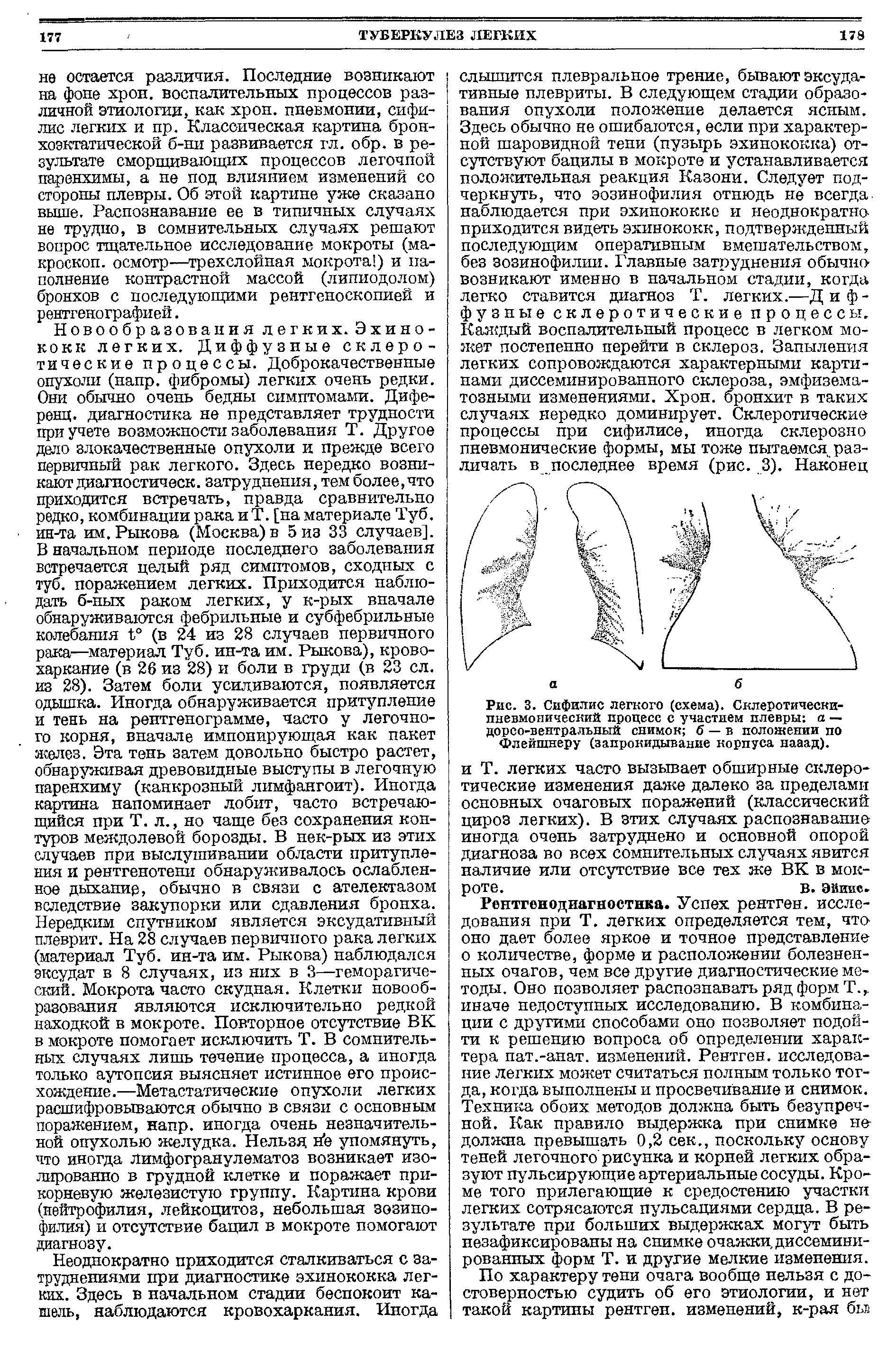 Рис. 3. Сифилис легкого (схема). Склеротически-пневмояический процесс с участием плевры а — дорсо-вентральный снимок б — в положении по Флейшнеру (запрокидывание корпуса нааад).