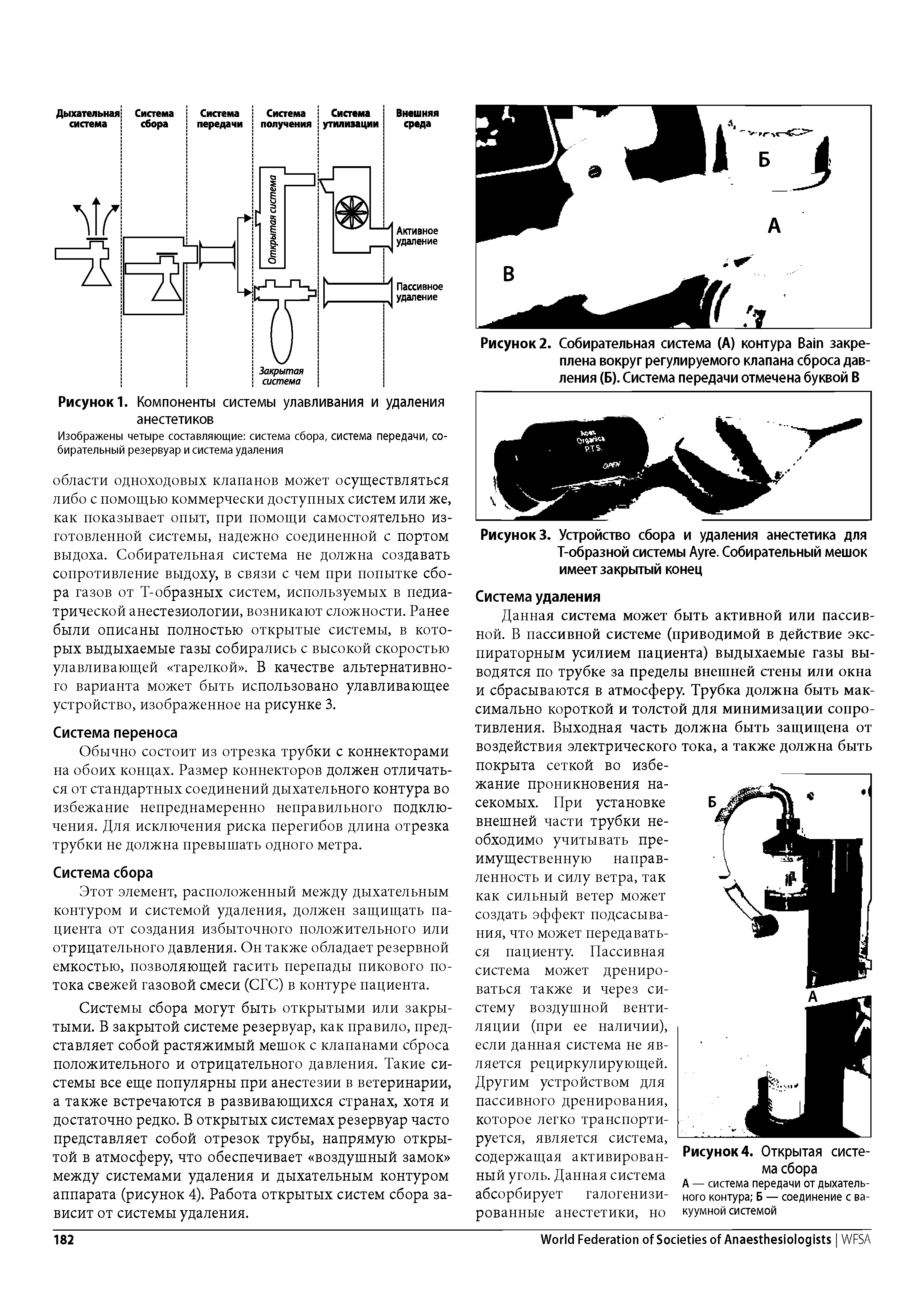 Рисунок 3. Устройство сбора и удаления анестетика для Т-образной системы Дуге. Собирательный мешок имеет закрытый конец...